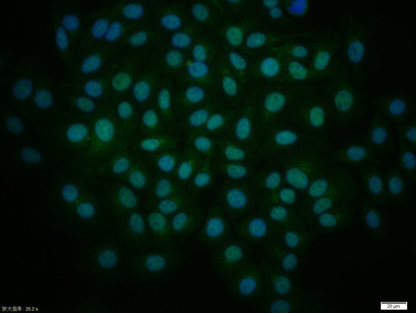HepG2 cells were stained with GLI1 Polyclonal Antibody, Unconjugated(bs-1206R) at 1:50 in PBS and incubated for two hours at 37°C followed by Goat Anti-Rabbit IgG (H+L) FITC conjugated secondary antibody. DAPI staining of the nucleus was done and then detected.