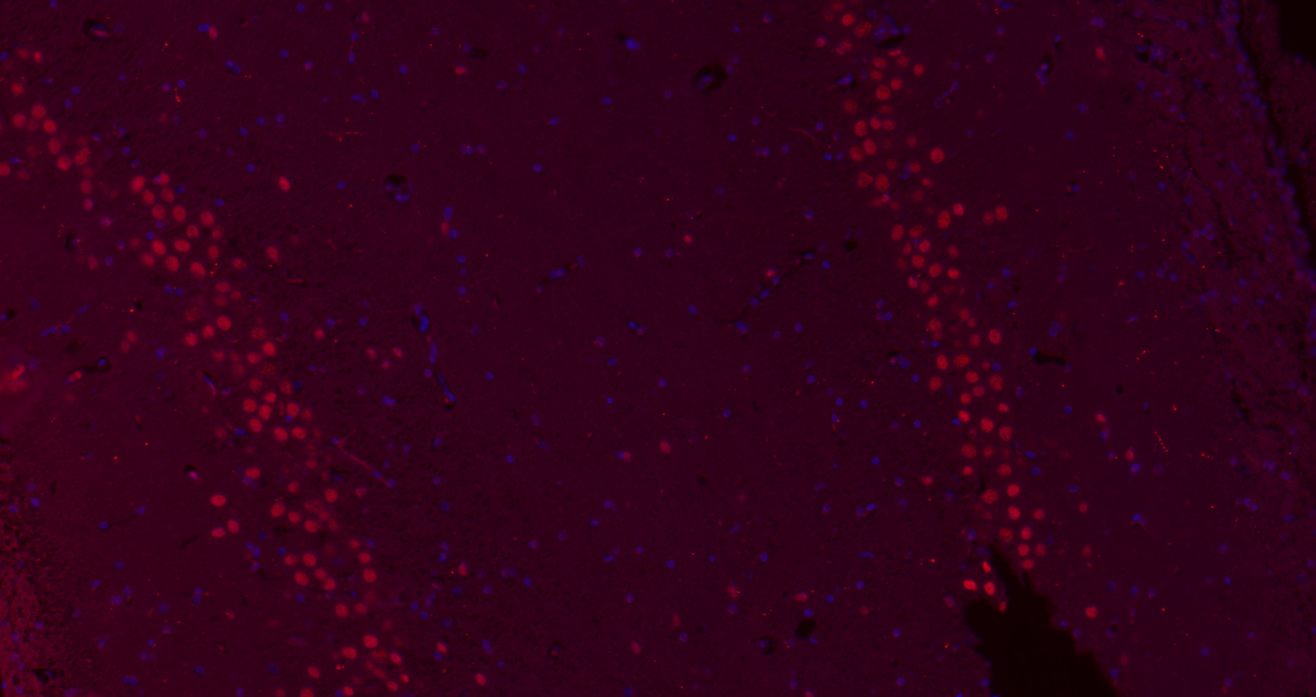 Paraformaldehyde-fixed, paraffin embedded (Rat brain); Antigen retrieval by boiling in sodium citrate buffer (pH6.0) for 15min; Block endogenous peroxidase by 3% hydrogen peroxide for 20 minutes; Blocking buffer (normal goat serum) at 37°C for 30min; Antibody incubation with (B MyB) Polyclonal Antibody, Unconjugated (bs-5960R) at 1:200 overnight at 4°C, followed by a conjugated Goat Anti-Rabbit IgG antibody (bs-0295G-AF647) for 90 minutes, and DAPI for nuclei staining.