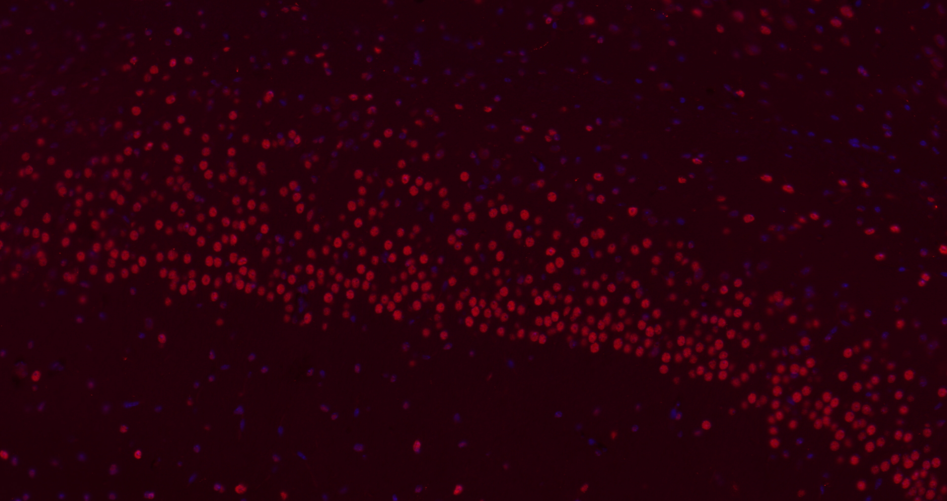 Paraformaldehyde-fixed, paraffin embedded (Mouse brain); Antigen retrieval by boiling in sodium citrate buffer (pH6.0) for 15min; Block endogenous peroxidase by 3% hydrogen peroxide for 20 minutes; Blocking buffer (normal goat serum) at 37°C for 30min; Antibody incubation with (B MyB) Polyclonal Antibody, Unconjugated (bs-5960R) at 1:200 overnight at 4°C, followed by a conjugated Goat Anti-Rabbit IgG antibody (bs-0295G-AF647) for 90 minutes, and DAPI for nuclei staining.