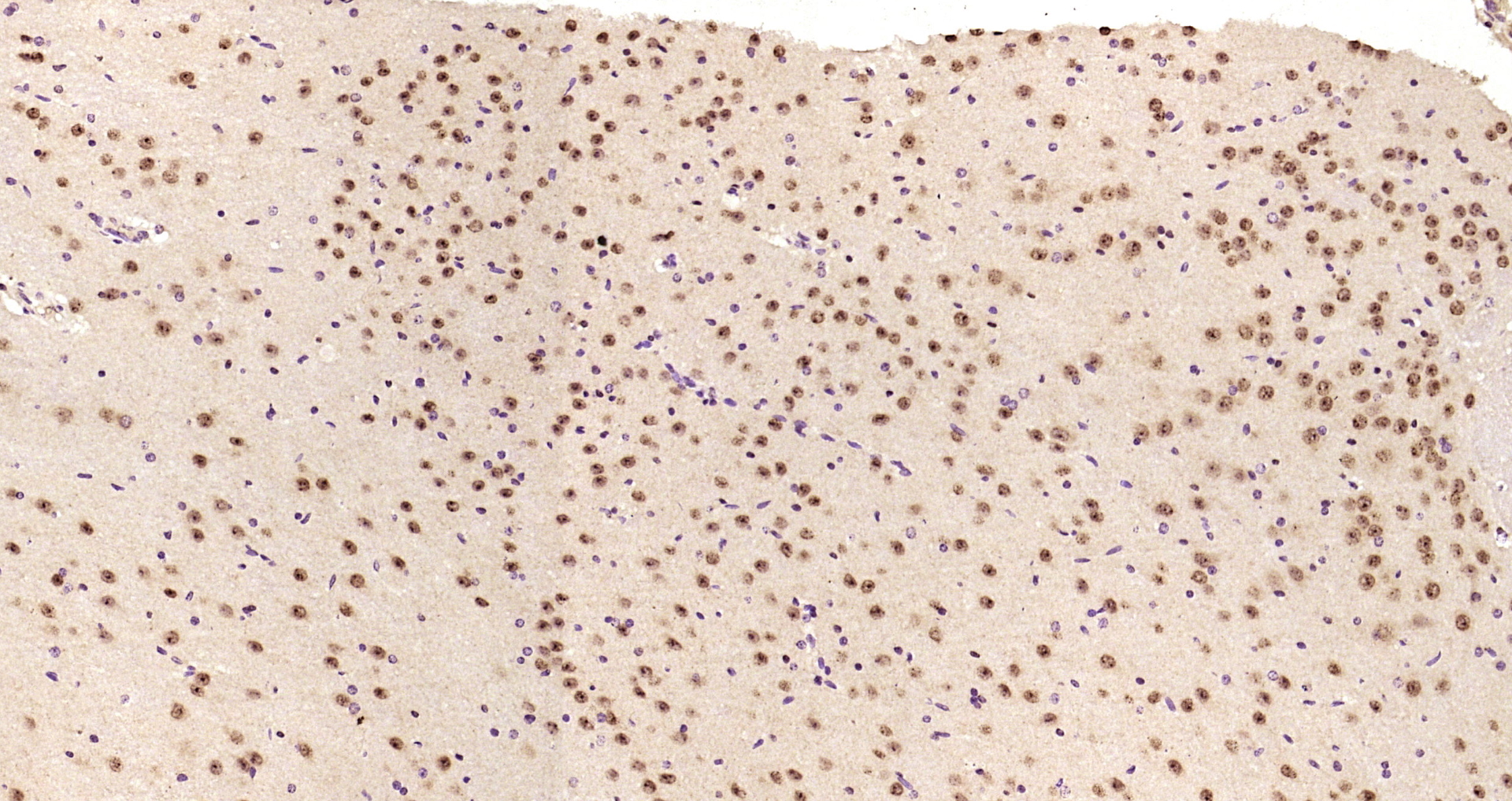 Paraformaldehyde-fixed, paraffin embedded Mouse brain; Antigen retrieval by boiling in sodium citrate buffer (pH6.0) for 15min; Block endogenous peroxidase by 3% hydrogen peroxide for 20 minutes; Blocking buffer (normal goat serum) at 37°C for 30min; Antibody incubation with MTA1 Polyclonal Antibody, Unconjugated (bs-1412R) at 1:200 overnight at 4°C, DAB staining.