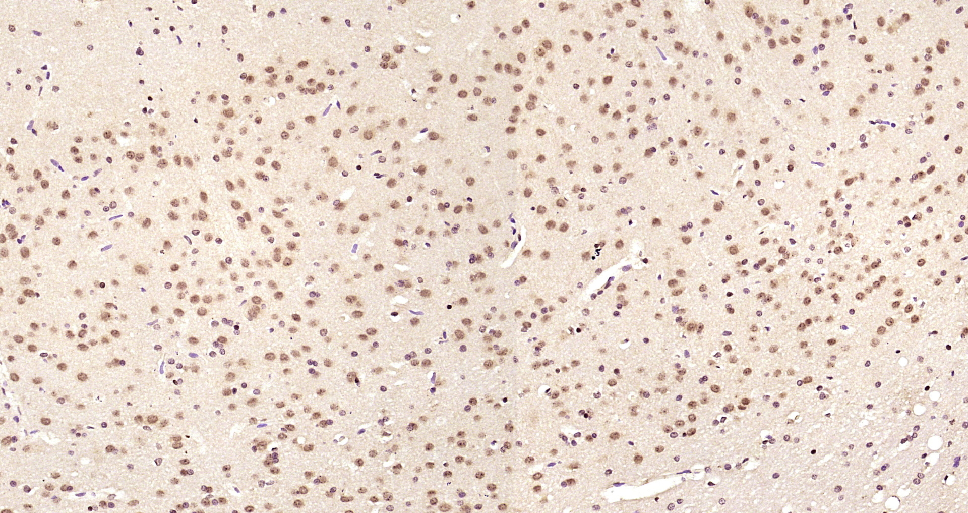 Paraformaldehyde-fixed, paraffin embedded Rat brain; Antigen retrieval by boiling in sodium citrate buffer (pH6.0) for 15min; Block endogenous peroxidase by 3% hydrogen peroxide for 20 minutes; Blocking buffer (normal goat serum) at 37°C for 30min; Antibody incubation with LIMK1 Polyclonal Antibody, Unconjugated (bs-2775R) at 1:200 overnight at 4°C, DAB staining.