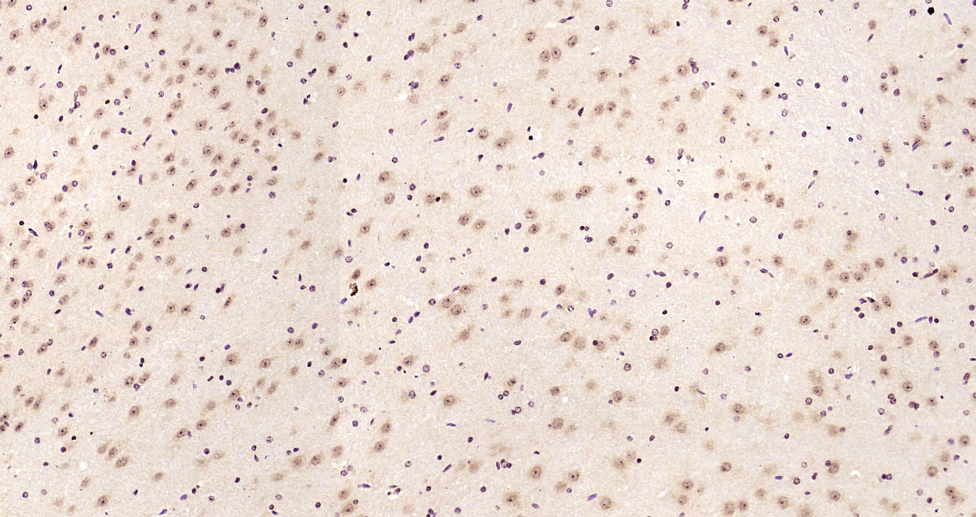 Paraformaldehyde-fixed, paraffin embedded Mouse brain; Antigen retrieval by boiling in sodium citrate buffer (pH6.0) for 15min; Block endogenous peroxidase by 3% hydrogen peroxide for 20 minutes; Blocking buffer (normal goat serum) at 37°C for 30min; Antibody incubation with LIMK1 Polyclonal Antibody, Unconjugated (bs-2775R) at 1:200 overnight at 4°C, DAB staining.