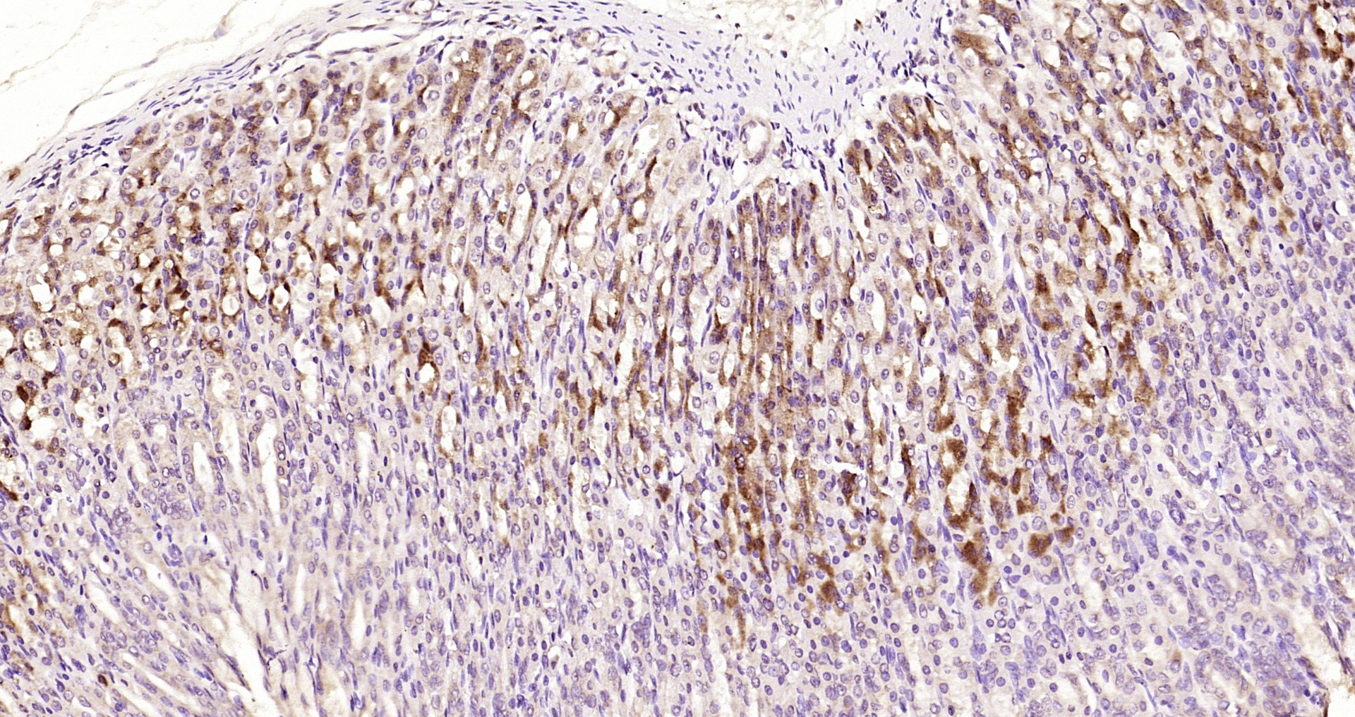 Paraformaldehyde-fixed, paraffin embedded Rat stomach; Antigen retrieval by boiling in sodium citrate buffer (pH6.0) for 15min; Block endogenous peroxidase by 3% hydrogen peroxide for 20 minutes; Blocking buffer (normal goat serum) at 37°C for 30min; Antibody incubation with GALT Polyclonal Antibody, Unconjugated (bs-3984R) at 1:200 overnight at 4°C, DAB staining.