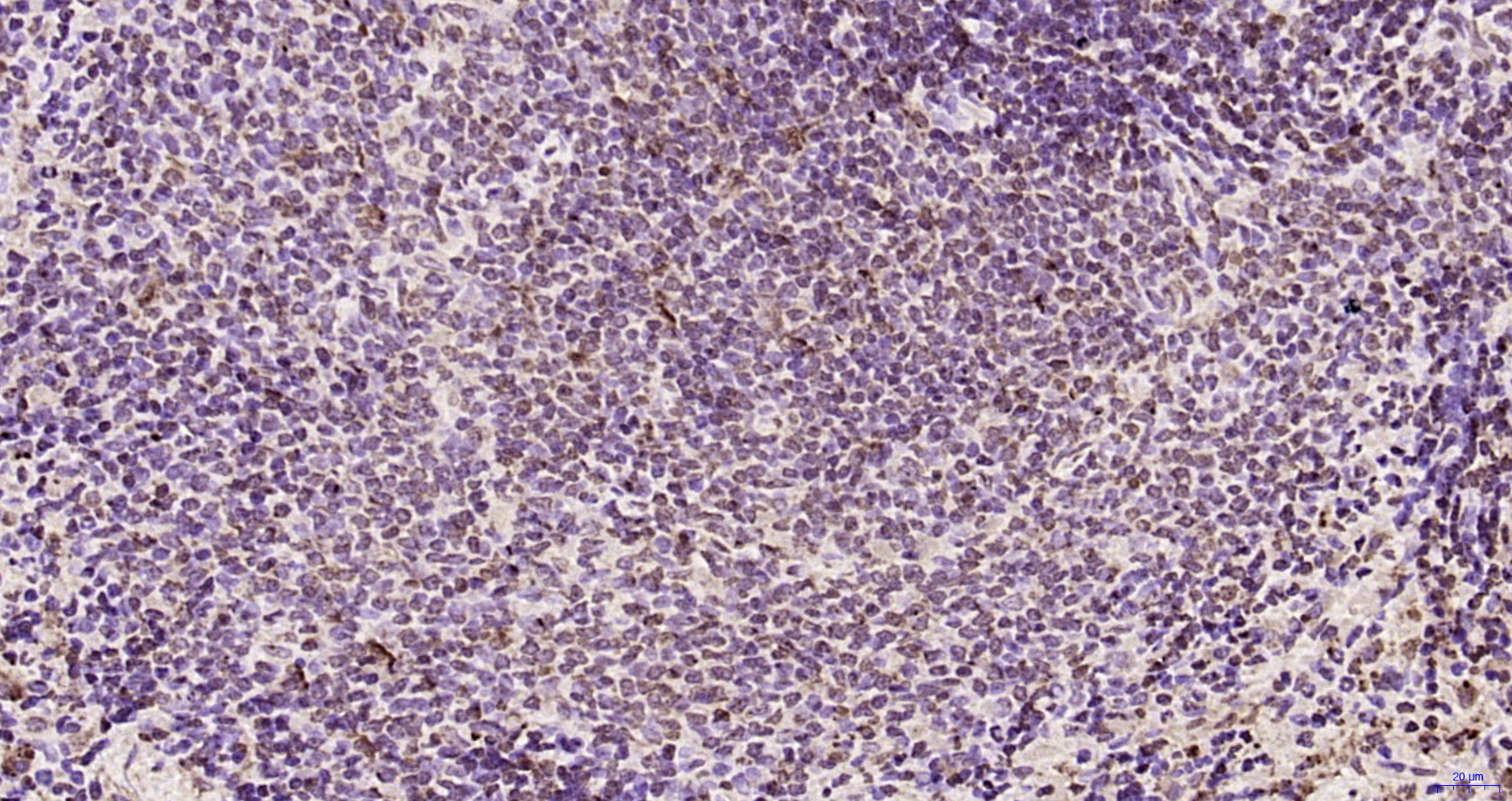 Paraformaldehyde-fixed, paraffin embedded Rat spleen; Antigen retrieval by boiling in sodium citrate buffer (pH6.0) for 15min; Block endogenous peroxidase by 3% hydrogen peroxide for 20 minutes; Blocking buffer (normal goat serum) at 37°C for 30min; Antibody incubation with ATF4/CREB-2 Polyclonal Antibody, Unconjugated (bs-1531R) at 1:200 overnight at 4°C, DAB staining. Paraformaldehyde-fixed, paraffin embedded Rat spleen; Antigen retrieval by boiling in sodium citrate buffer (pH6.0) for 15min; Block endogenous peroxidase by 3% hydrogen peroxide for 20 minutes; Blocking buffer (normal goat serum) at 37°C for 30min; Antibody incubation with ATF4/CREB-2 Polyclonal Antibody, Unconjugated (bs-1531R) at 1:200 overnight at 4°C, DAB staining.