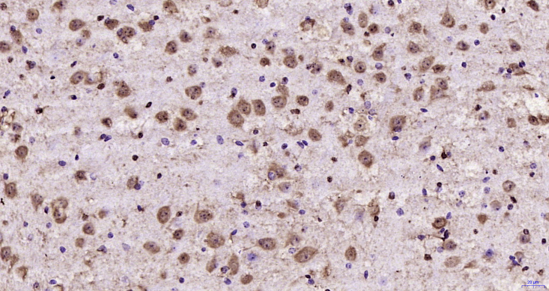 Paraformaldehyde-fixed, paraffin embedded Mouse brain; Antigen retrieval by boiling in sodium citrate buffer (pH6.0) for 15min; Block endogenous peroxidase by 3% hydrogen peroxide for 20 minutes; Blocking buffer (normal goat serum) at 37°C for 30min; Antibody incubation with ATF4/CREB-2 Polyclonal Antibody, Unconjugated (bs-1531R) at 1:200 overnight at 4°C, DAB staining.