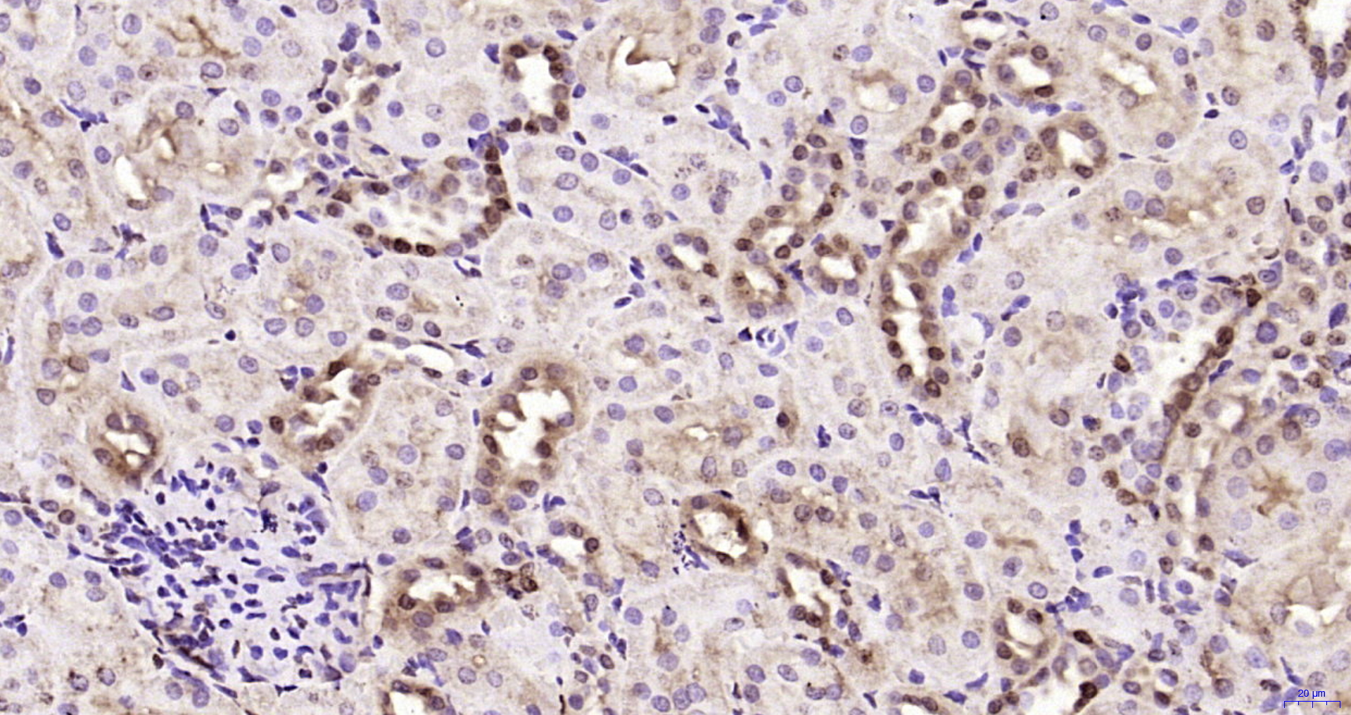 Paraformaldehyde-fixed, paraffin embedded Rat kidney; Antigen retrieval by boiling in sodium citrate buffer (pH6.0) for 15min; Block endogenous peroxidase by 3% hydrogen peroxide for 20 minutes; Blocking buffer (normal goat serum) at 37°C for 30min; Antibody incubation with _x000D_ JNK1+2+3 Polyclonal Antibody, Unconjugated (bs-2592R) at 1:200 overnight at 4°C, DAB staining.