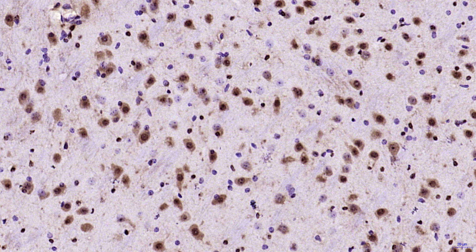 Paraformaldehyde-fixed, paraffin embedded Mouse brain; Antigen retrieval by boiling in sodium citrate buffer (pH6.0) for 15min; Block endogenous peroxidase by 3% hydrogen peroxide for 20 minutes; Blocking buffer (normal goat serum) at 37°C for 30min; Antibody incubation with JNK1+2+3 Polyclonal Antibody, Unconjugated (bs-2592R) at 1:200 overnight at 4°C, DAB staining.