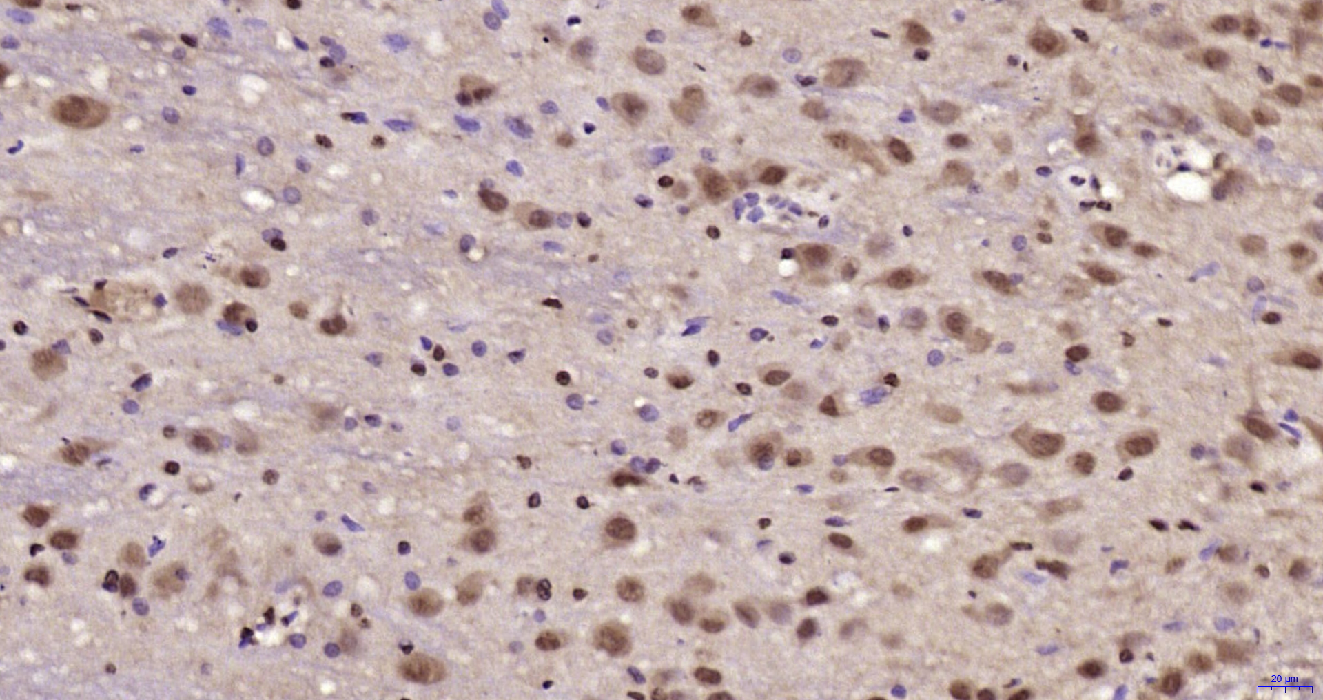 Paraformaldehyde-fixed, paraffin embedded Rat brain; Antigen retrieval by boiling in sodium citrate buffer (pH6.0) for 15min; Block endogenous peroxidase by 3% hydrogen peroxide for 20 minutes; Blocking buffer (normal goat serum) at 37°C for 30min; Antibody incubation with JNK1+2+3 Polyclonal Antibody, Unconjugated (bs-2592R) at 1:200 overnight at 4°C, DAB staining.