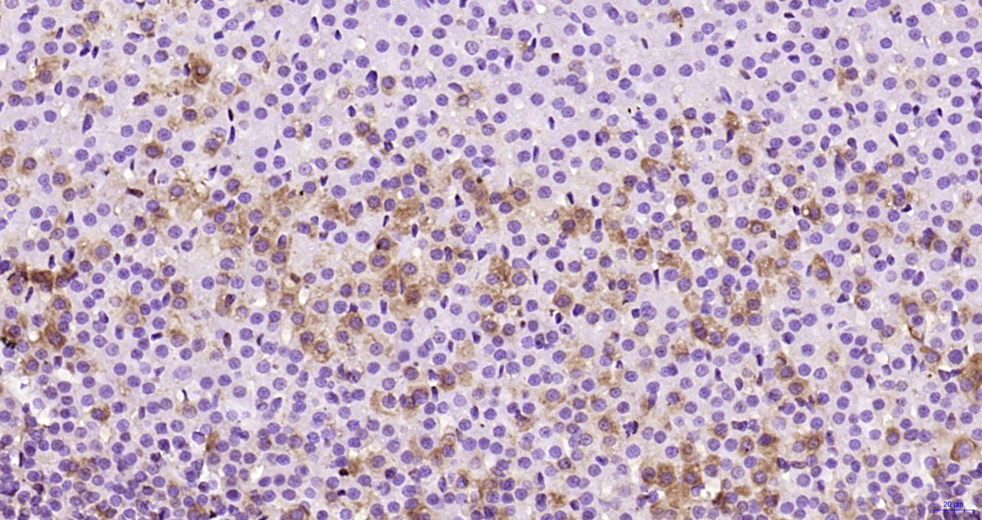 Paraformaldehyde-fixed, paraffin embedded Rat adrenal gland; Antigen retrieval by boiling in sodium citrate buffer (pH6.0) for 15min; Block endogenous peroxidase by 3% hydrogen peroxide for 20 minutes; Blocking buffer (normal goat serum) at 37°C for 30min; Antibody incubation with ADCY1 Polyclonal Antibody, Unconjugated (bs-3681R) at 1:200 overnight at 4°C, DAB staining.