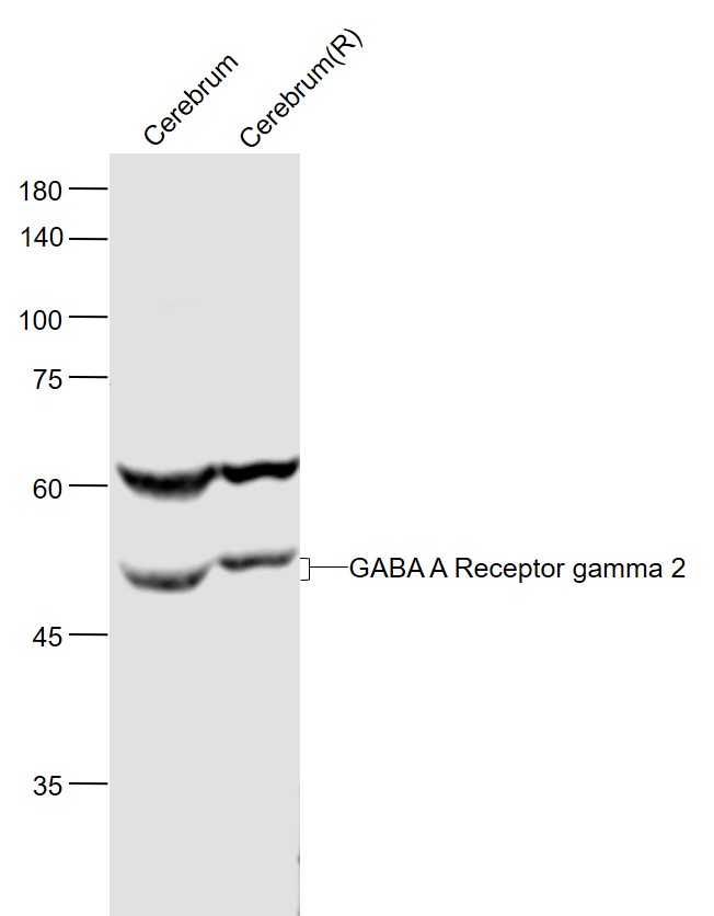 Lane 1: Mouse Cerebrum lysates; Lane 2: Rat Cerebrum lysates probed with GABA A Receptor gamma 2 Polyclonal Antibody, Unconjugated (bs-4112R) at 1:1000 dilution and 4˚C overnight incubation. Followed by conjugated secondary antibody incubation at 1:20000 for 60 min at 37˚C.