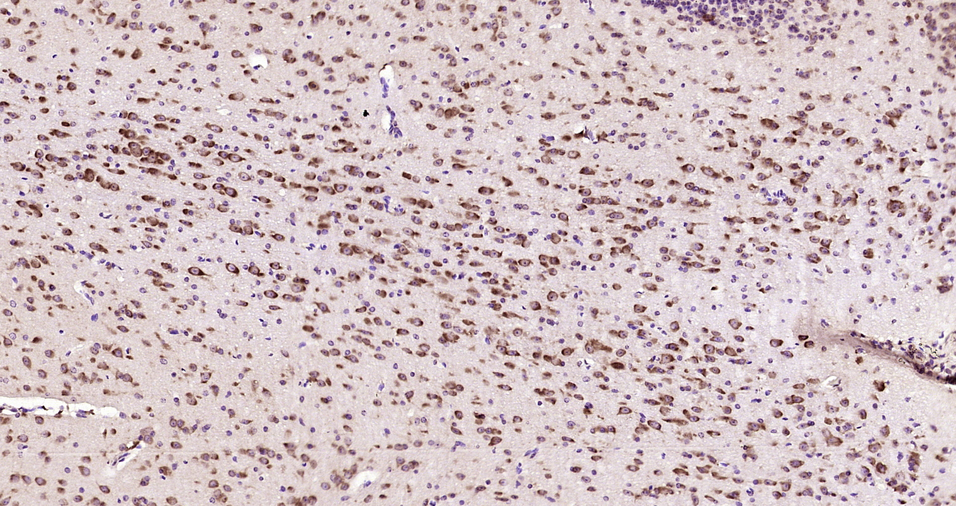 Paraformaldehyde-fixed, paraffin embedded Mouse brain; Antigen retrieval by boiling in sodium citrate buffer (pH6.0) for 15min; Block endogenous peroxidase by 3% hydrogen peroxide for 20 minutes; Blocking buffer (normal goat serum) at 37°C for 30min; Antibody incubation with ACPL2 Polyclonal Antibody, Unconjugated (bs-9348R) at 1:200 overnight at 4°C, DAB staining.