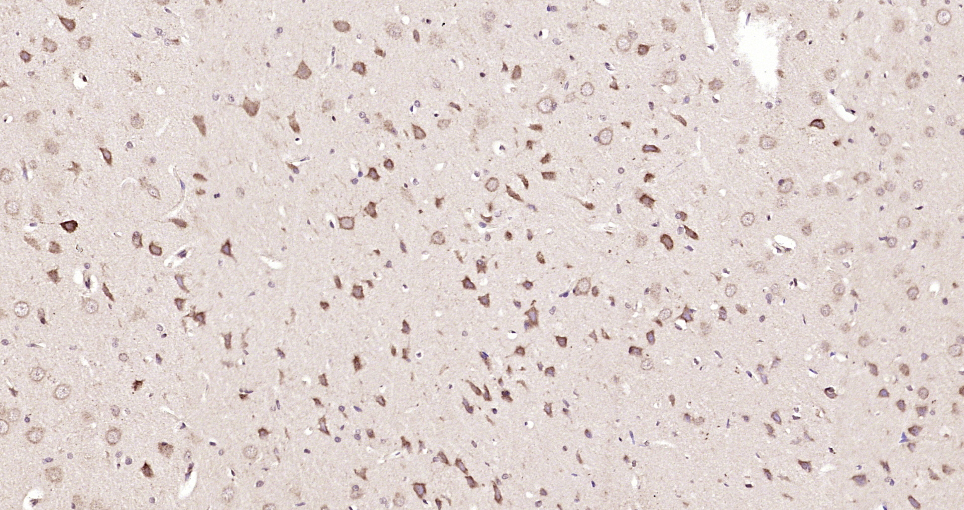 Paraformaldehyde-fixed, paraffin embedded Rat brain; Antigen retrieval by boiling in sodium citrate buffer (pH6.0) for 15min; Block endogenous peroxidase by 3% hydrogen peroxide for 20 minutes; Blocking buffer (normal goat serum) at 37°C for 30min; Antibody incubation with ANKRD33B Polyclonal Antibody, Unconjugated (bs-9397R) at 1:200 overnight at 4°C, DAB staining.