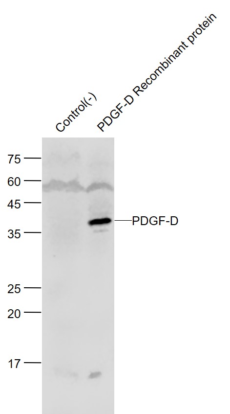 Lane 1: Control (-) Cell Lysate; Lane 2:Human PDGF-D (Full Length) Overexpression cell lysates probed with PDGF-D Polyclonal Antibody, Unconjugated (bs-5776R) at 1:2000 dilution and 4˚C overnight incubation. Followed by conjugated secondary antibody incubation at 1:20000 for 60 min at 37˚C.