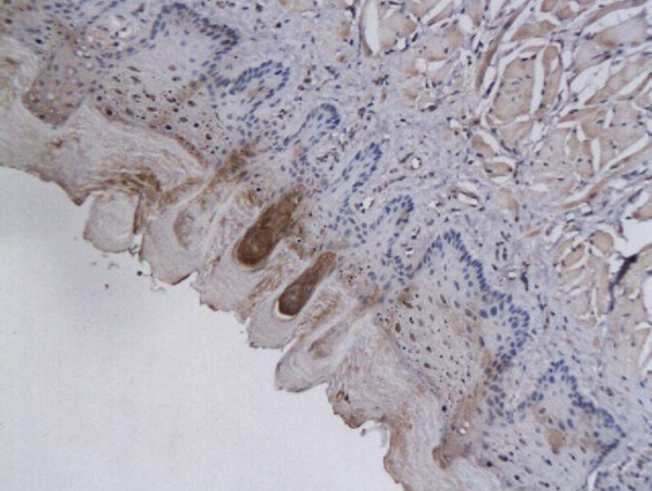 Formalin-fixed and paraffin embedded rat tongue labeled with Anti-AKR1B1 Polyclonal Antibody, Unconjugated (bs-2405R) followed by conjugation to the secondary antibody