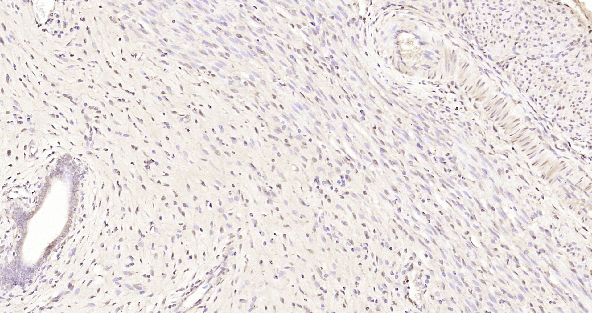 Paraformaldehyde-fixed, paraffin embedded Rat uterus; Antigen retrieval by boiling in sodium citrate buffer (pH6.0) for 15min; Block endogenous peroxidase by 3% hydrogen peroxide for 20 minutes; Blocking buffer (normal goat serum) at 37°C for 30min; Antibody incubation with Progesterone Receptor Polyclonal Antibody, Unconjugated (bs-23376R) at 1:200 overnight at 4°C, DAB staining.