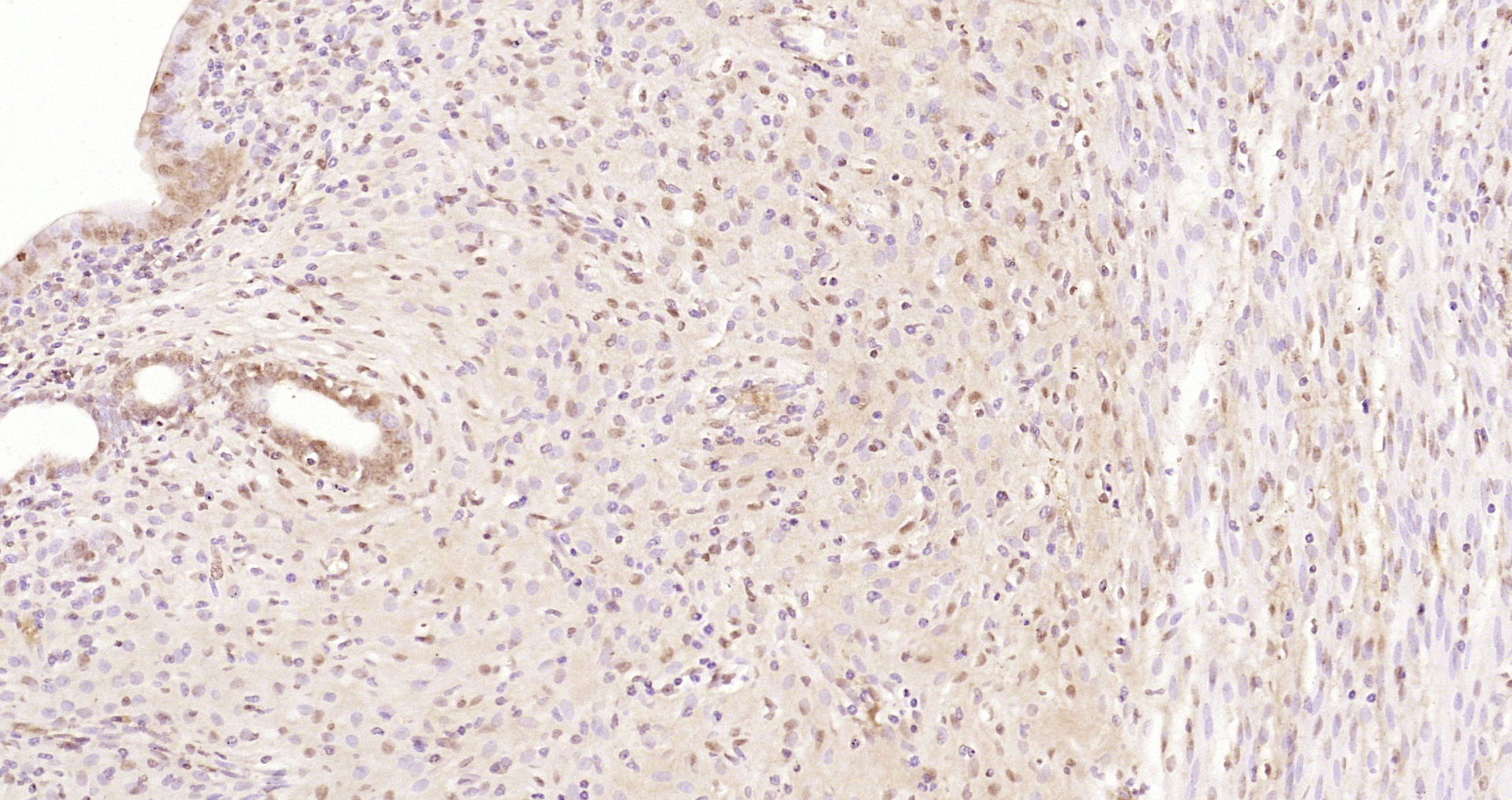 Paraformaldehyde-fixed, paraffin embedded Rat uterus; Antigen retrieval by boiling in sodium citrate buffer (pH6.0) for 15min; Block endogenous peroxidase by 3% hydrogen peroxide for 20 minutes; Blocking buffer (normal goat serum) at 37°C for 30min; Antibody incubation with JNK1+3 Polyclonal Antibody, Unconjugated (bs-0501R) at 1:200 overnight at 4°C, DAB staining.