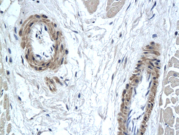 Formalin-fixed and paraffin embedded human heart tissue labeled with Anti-PAX7 Polyclonal Antibody, Unconjugated (bs-2413R) followed by conjugation to the secondary antibody