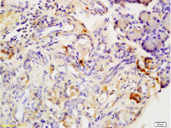 Formalin-fixed and paraffin embedded rat pancreas labeled with Anti-Adiponectin Receptor 2 Polyclonal Antibody, Unconjugated (bs-0611R) at 1:200, followed by conjugation to the secondary antibody and DAB staining