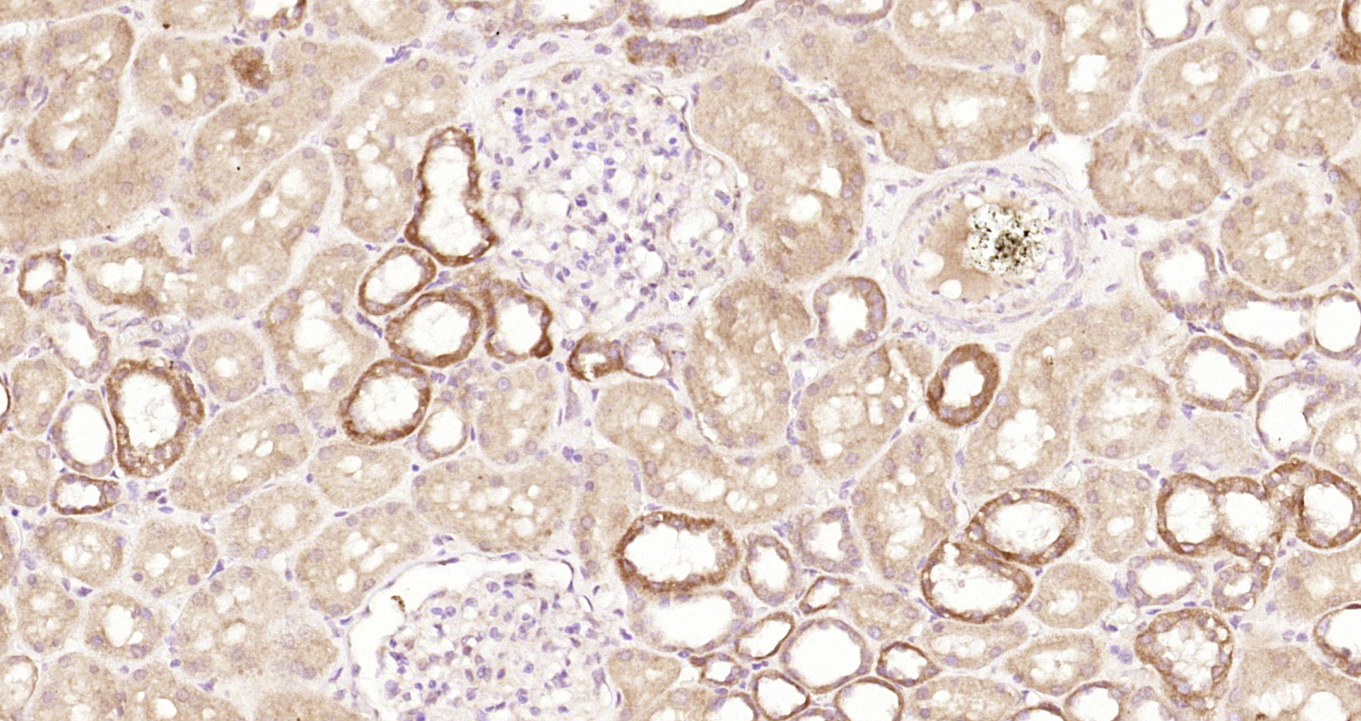 Paraformaldehyde-fixed, paraffin embedded Human kidney; Antigen retrieval by boiling in sodium citrate buffer (pH6.0) for 15min; Block endogenous peroxidase by 3% hydrogen peroxide for 20 minutes; Blocking buffer (normal goat serum) at 37°C for 30min; Antibody incubation with SPARC Polyclonal Antibody, Unconjugated (bs-1133R) at 1:200 overnight at 4°C, DAB staining.