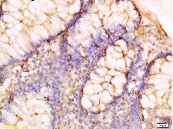 Formalin-fixed and paraffin embedded human rectal tissue labeled with Anti-Adiponectin Receptor 2 Polyclonal Antibody, Unconjugated (bs-0611R) at 1:300, followed by conjugation to the secondary antibody and DAB staining