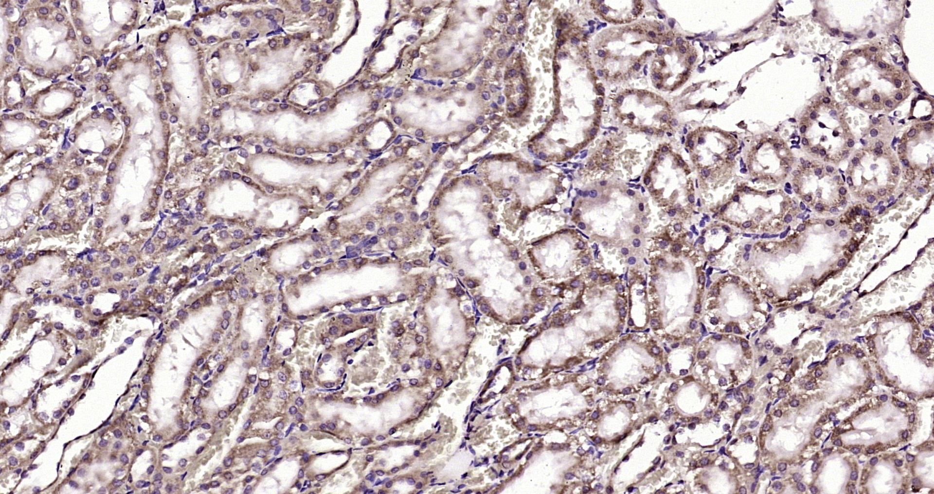 Paraformaldehyde-fixed, paraffin embedded Rat kidney; Antigen retrieval by boiling in sodium citrate buffer (pH6.0) for 15min; Block endogenous peroxidase by 3% hydrogen peroxide for 20 minutes; Blocking buffer (normal goat serum) at 37°C for 30min; Antibody incubation with ABCB6 Polyclonal Antibody, Unconjugated (bs-1224R) at 1:200 overnight at 4°C, DAB staining.