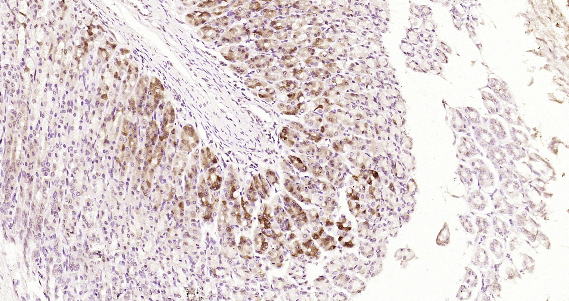 Paraformaldehyde-fixed, paraffin embedded Rat stomach; Antigen retrieval by boiling in sodium citrate buffer (pH6.0) for 15min; Block endogenous peroxidase by 3% hydrogen peroxide for 20 minutes; Blocking buffer (normal goat serum) at 37°C for 30min; Antibody incubation with Shh Polyclonal Antibody, Unconjugated (bs-1544R) at 1:200 overnight at 4°C, DAB staining.