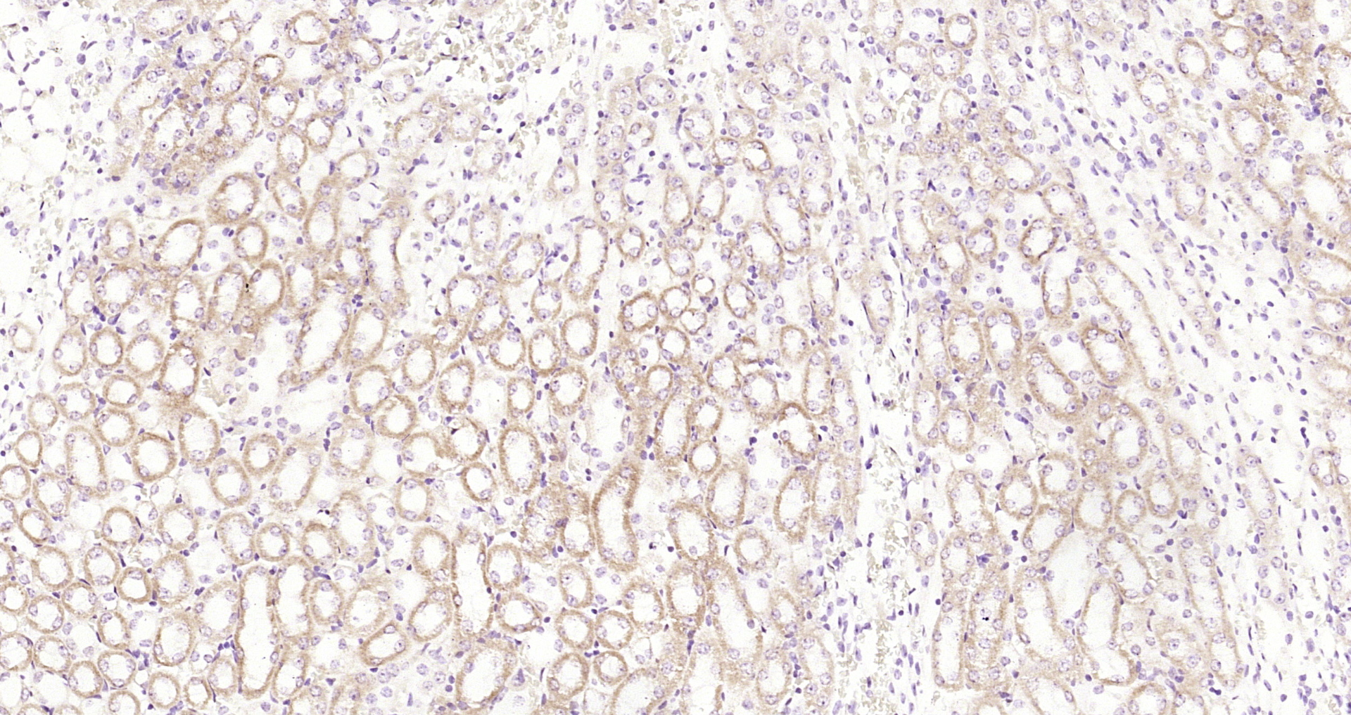 Paraformaldehyde-fixed, paraffin embedded Mouse kidney; Antigen retrieval by boiling in sodium citrate buffer (pH6.0) for 15min; Block endogenous peroxidase by 3% hydrogen peroxide for 20 minutes; Blocking buffer (normal goat serum) at 37°C for 30min; Antibody incubation with Cathepsin H/CTSH Polyclonal Antibody, Unconjugated (bs-1670R) at 1:200 overnight at 4°C, DAB staining.