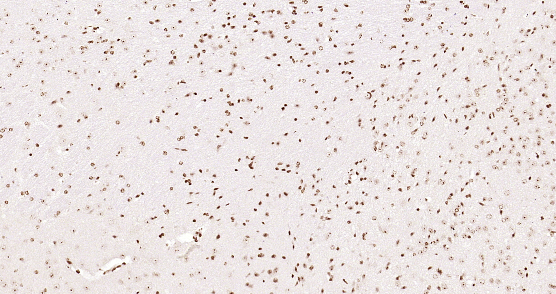 Paraformaldehyde-fixed, paraffin embedded Mouse brain; Antigen retrieval by boiling in sodium citrate buffer (pH6.0) for 15min; Block endogenous peroxidase by 3% hydrogen peroxide for 20 minutes; Blocking buffer (normal goat serum) at 37°C for 30min; Antibody incubation with OGG1 Polyclonal Antibody, Unconjugated (bs-3687R) at 1:200 overnight at 4°C, DAB staining.