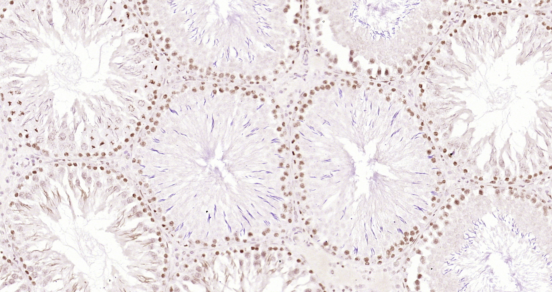 Paraformaldehyde-fixed, paraffin embedded Rat testis; Antigen retrieval by boiling in sodium citrate buffer (pH6.0) for 15min; Block endogenous peroxidase by 3% hydrogen peroxide for 20 minutes; Blocking buffer (normal goat serum) at 37°C for 30min; Antibody incubation with OGG1 Polyclonal Antibody, Unconjugated (bs-3687R) at 1:200 overnight at 4°C, DAB staining.