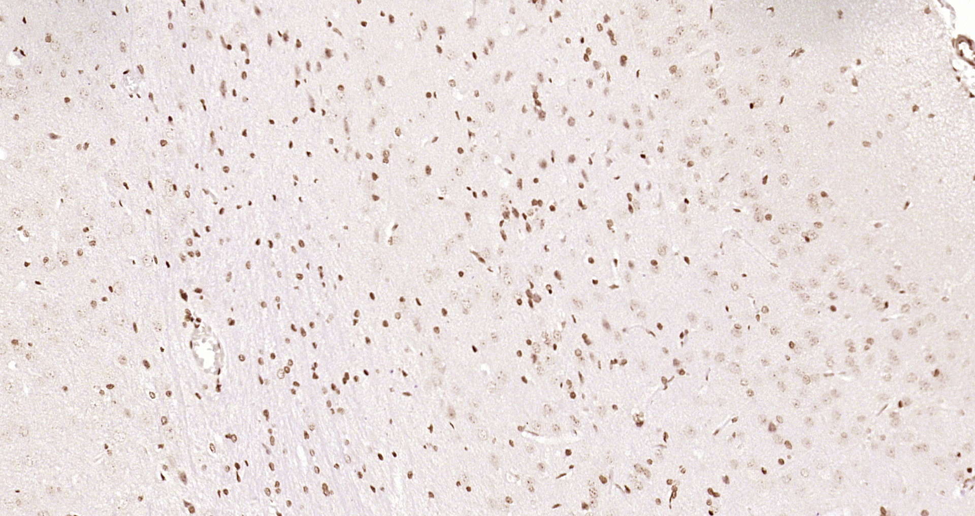Paraformaldehyde-fixed, paraffin embedded Rat brain; Antigen retrieval by boiling in sodium citrate buffer (pH6.0) for 15min; Block endogenous peroxidase by 3% hydrogen peroxide for 20 minutes; Blocking buffer (normal goat serum) at 37°C for 30min; Antibody incubation with OGG1 Polyclonal Antibody, Unconjugated (bs-3687R) at 1:200 overnight at 4°C, DAB staining.