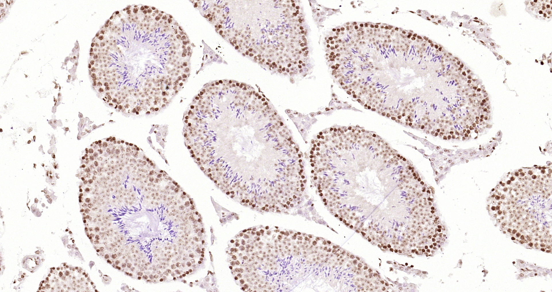 Paraformaldehyde-fixed, paraffin embedded Mouse testis; Antigen retrieval by boiling in sodium citrate buffer (pH6.0) for 15min; Block endogenous peroxidase by 3% hydrogen peroxide for 20 minutes; Blocking buffer (normal goat serum) at 37°C for 30min; Antibody incubation with OGG1 Polyclonal Antibody, Unconjugated (bs-3687R) at 1:200 overnight at 4°C, DAB staining.