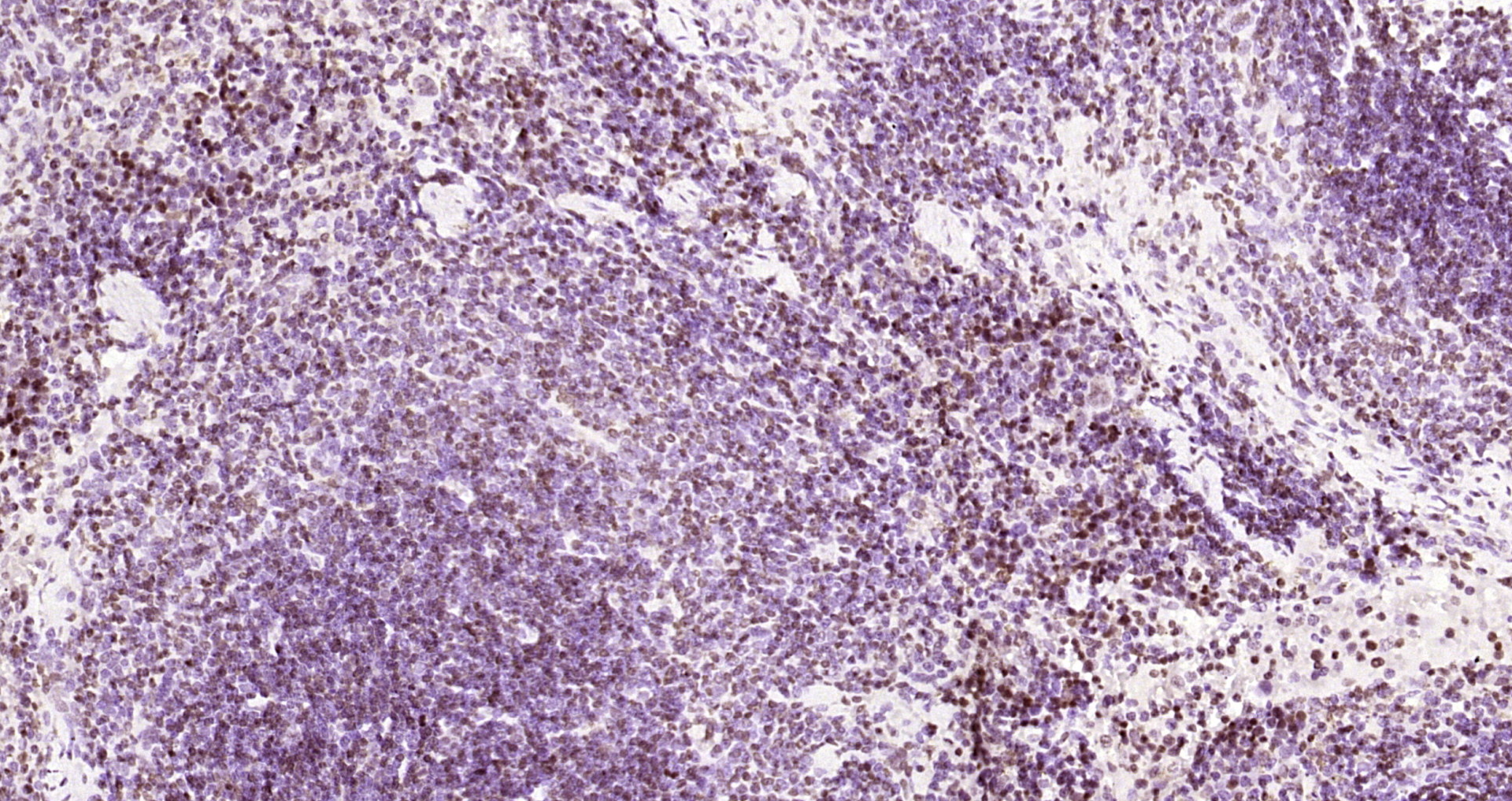 Paraformaldehyde-fixed, paraffin embedded Mouse spleen; Antigen retrieval by boiling in sodium citrate buffer (pH6.0) for 15min; Block endogenous peroxidase by 3% hydrogen peroxide for 20 minutes; Blocking buffer (normal goat serum) at 37°C for 30min; Antibody incubation with OGG1 Polyclonal Antibody, Unconjugated (bs-3687R) at 1:200 overnight at 4°C, DAB staining.