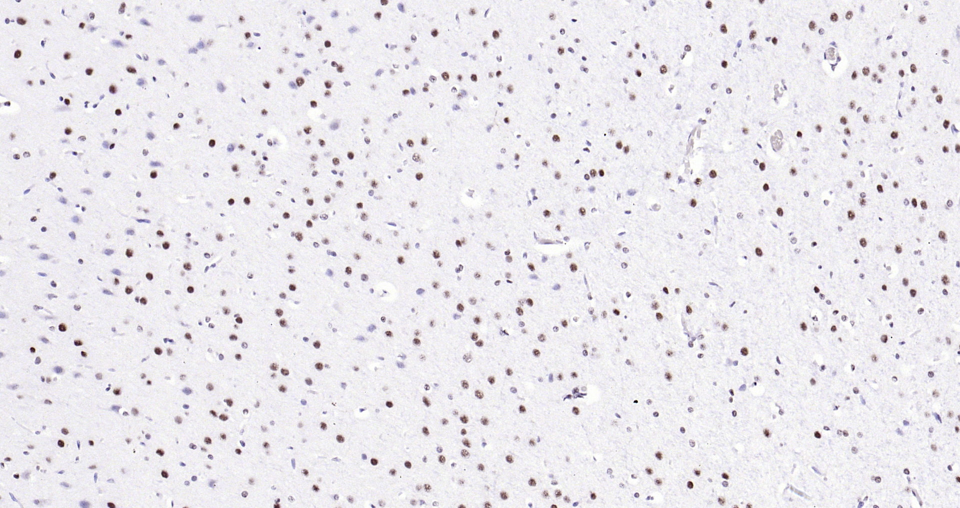 Paraformaldehyde-fixed, paraffin embedded Mouse brain; Antigen retrieval by boiling in sodium citrate buffer (pH6.0) for 15min; Block endogenous peroxidase by 3% hydrogen peroxide for 20 minutes; Blocking buffer (normal goat serum) at 37°C for 30min; Antibody incubation with B MyB Polyclonal Antibody, Unconjugated (bs-5960R) at 1:200 overnight at 4°C, DAB staining.