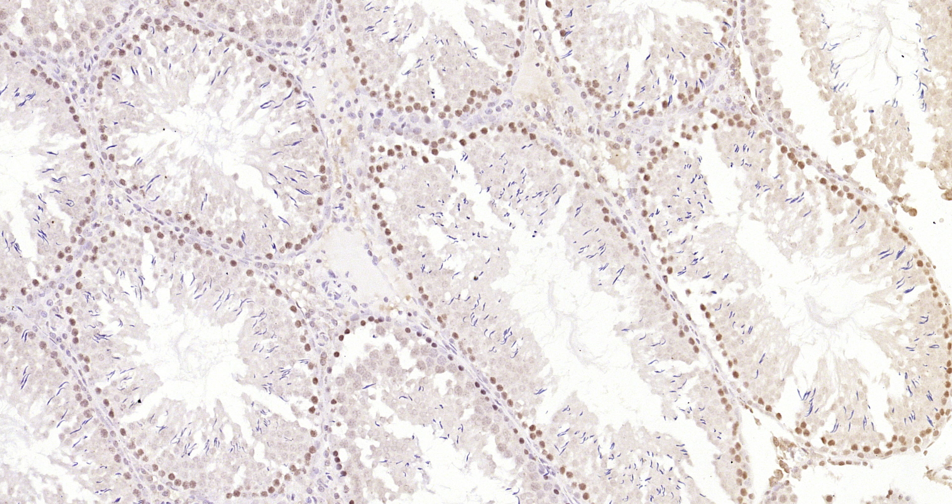 Paraformaldehyde-fixed, paraffin embedded Rat testis; Antigen retrieval by boiling in sodium citrate buffer (pH6.0) for 15min; Block endogenous peroxidase by 3% hydrogen peroxide for 20 minutes; Blocking buffer (normal goat serum) at 37°C for 30min; Antibody incubation with METTL11A Polyclonal Antibody, Unconjugated (bs-6057R) at 1:200 overnight at 4°C, DAB staining. Paraformaldehyde-fixed, paraffin embedded Rat testis; Antigen retrieval by boiling in sodium citrate buffer (pH6.0) for 15min; Block endogenous peroxidase by 3% hydrogen peroxide for 20 minutes; Blocking buffer (normal goat serum) at 37°C for 30min; Antibody incubation with METTL11A Polyclonal Antibody, Unconjugated (bs-6057R) at 1:200 overnight at 4°C, DAB staining.