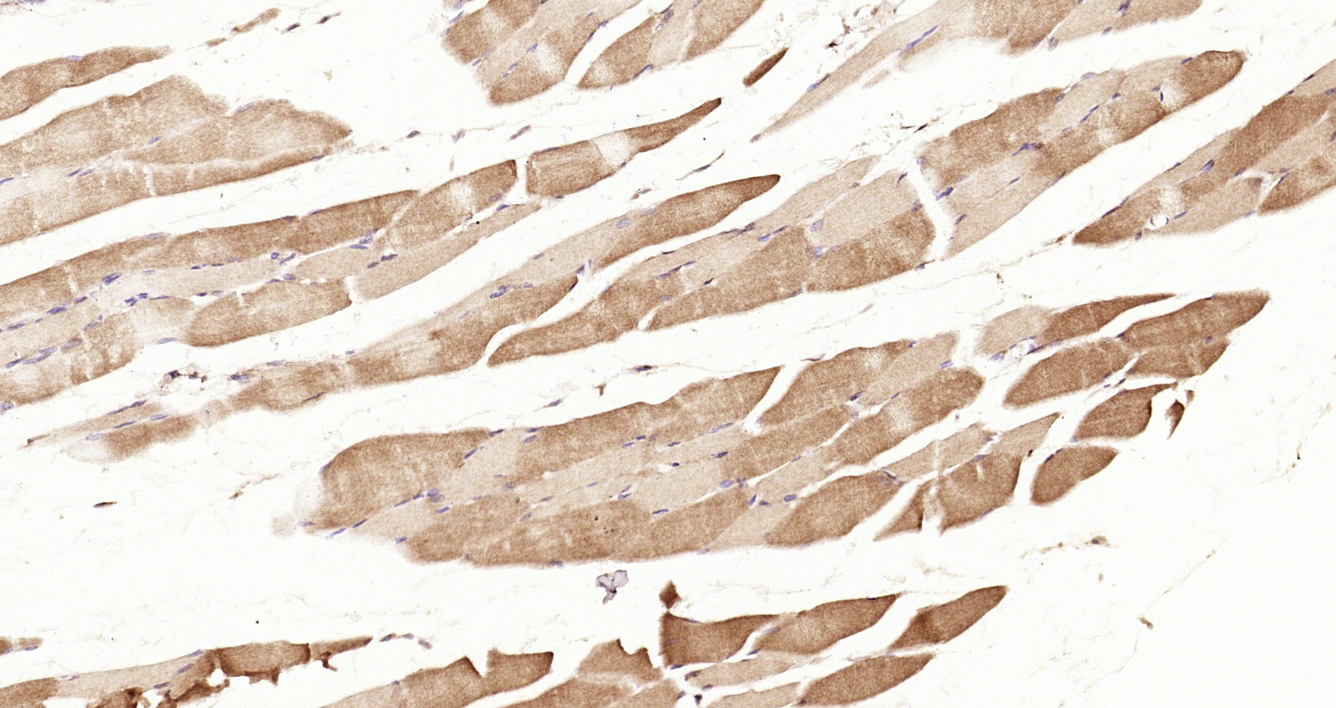 Paraformaldehyde-fixed, paraffin embedded Rat muscle; Antigen retrieval by boiling in sodium citrate buffer (pH6.0) for 15min; Block endogenous peroxidase by 3% hydrogen peroxide for 20 minutes; Blocking buffer (normal goat serum) at 37°C for 30min; Antibody incubation with RERG Polyclonal Antibody, Unconjugated (bs-6091R) at 1:200 overnight at 4°C, DAB staining.