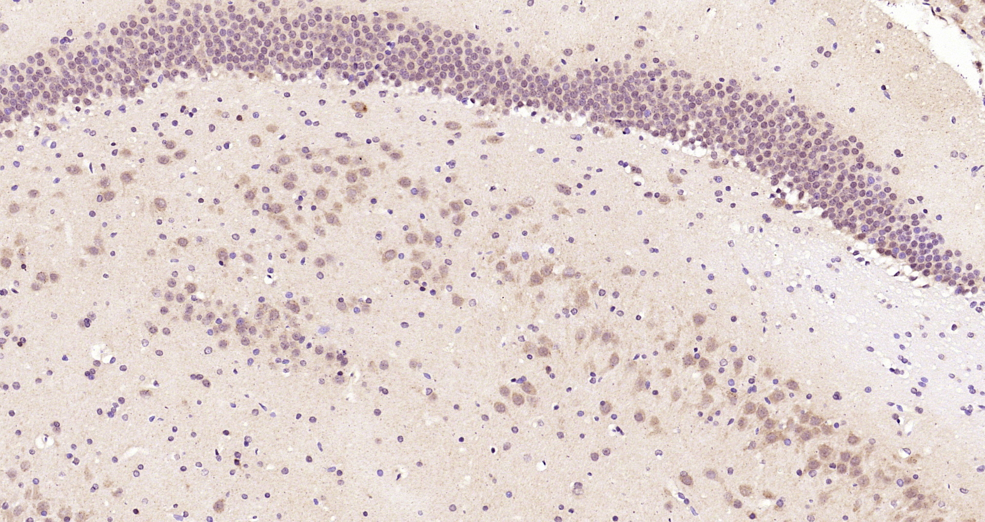 Paraformaldehyde-fixed, paraffin embedded Rat brain; Antigen retrieval by boiling in sodium citrate buffer (pH6.0) for 15min; Block endogenous peroxidase by 3% hydrogen peroxide for 20 minutes; Blocking buffer (normal goat serum) at 37°C for 30min; Antibody incubation with OCIAD1 Polyclonal Antibody, Unconjugated (bs-7001R) at 1:200 overnight at 4°C, DAB staining.