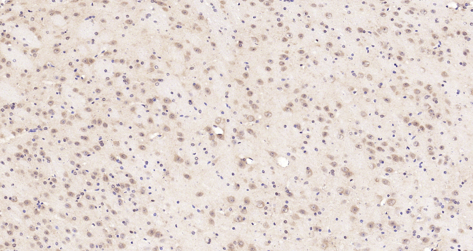 Paraformaldehyde-fixed, paraffin embedded Mouse brain; Antigen retrieval by boiling in sodium citrate buffer (pH6.0) for 15min; Block endogenous peroxidase by 3% hydrogen peroxide for 20 minutes; Blocking buffer (normal goat serum) at 37°C for 30min; Antibody incubation with OCIAD1 Polyclonal Antibody, Unconjugated (bs-7001R) at 1:200 overnight at 4°C, DAB staining.