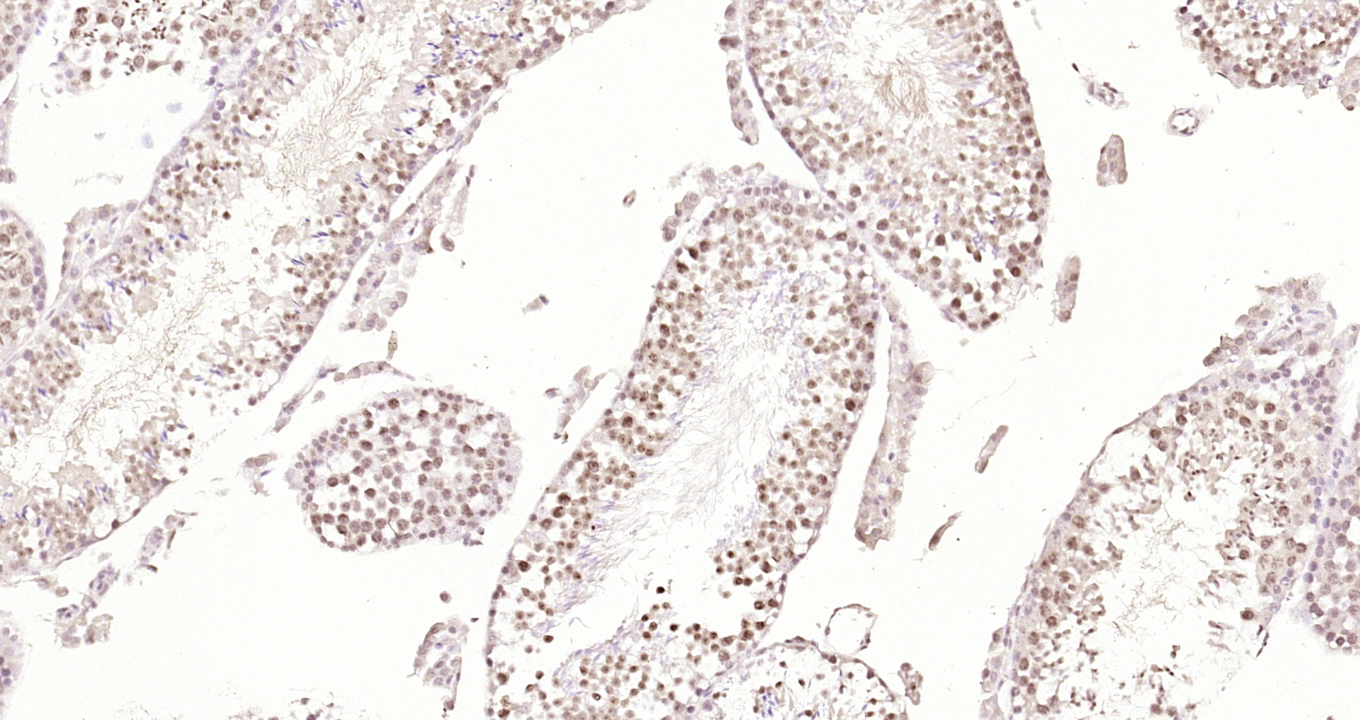 Paraformaldehyde-fixed, paraffin embedded Mouse testis; Antigen retrieval by boiling in sodium citrate buffer (pH6.0) for 15min; Block endogenous peroxidase by 3% hydrogen peroxide for 20 minutes; Blocking buffer (normal goat serum) at 37°C for 30min; Antibody incubation with RERE Polyclonal Antibody, Unconjugated (bs-7077R) at 1:200 overnight at 4°C, DAB staining.
