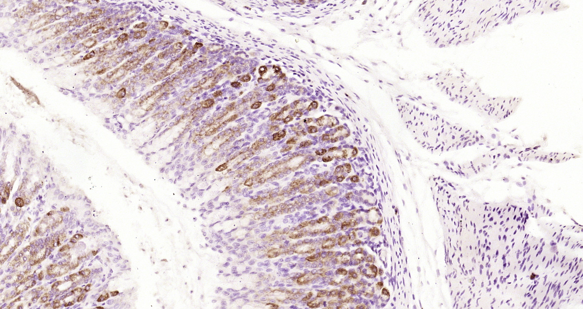 Paraformaldehyde-fixed, paraffin embedded Rat stomach; Antigen retrieval by boiling in sodium citrate buffer (pH6.0) for 15min; Block endogenous peroxidase by 3% hydrogen peroxide for 20 minutes; Blocking buffer (normal goat serum) at 37°C for 30min; Antibody incubation with MUC5AC Polyclonal Antibody, Unconjugated (bs-7166R) at 1:200 overnight at 4°C, DAB staining.