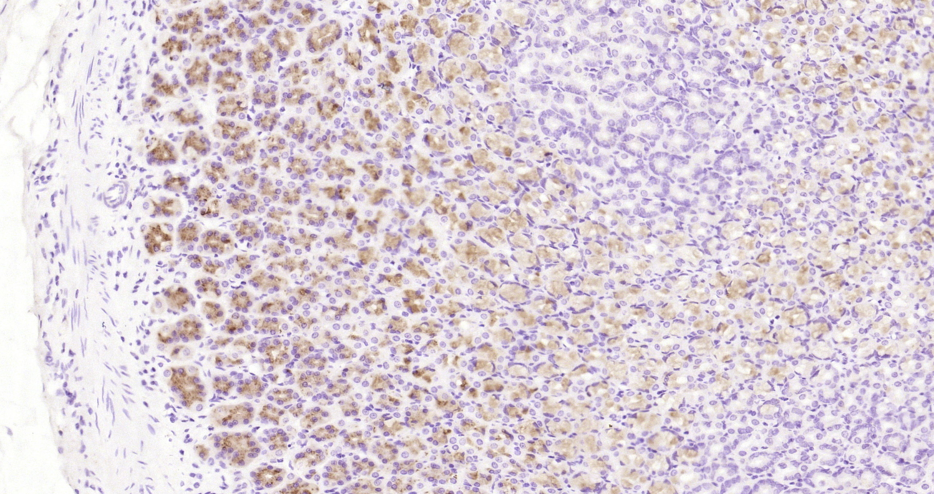 Paraformaldehyde-fixed, paraffin embedded Mouse stomach; Antigen retrieval by boiling in sodium citrate buffer (pH6.0) for 15min; Block endogenous peroxidase by 3% hydrogen peroxide for 20 minutes; Blocking buffer (normal goat serum) at 37°C for 30min; Antibody incubation with CCDC80 Polyclonal Antibody, Unconjugated (bs-7992R) at 1:200 overnight at 4°C, DAB staining.