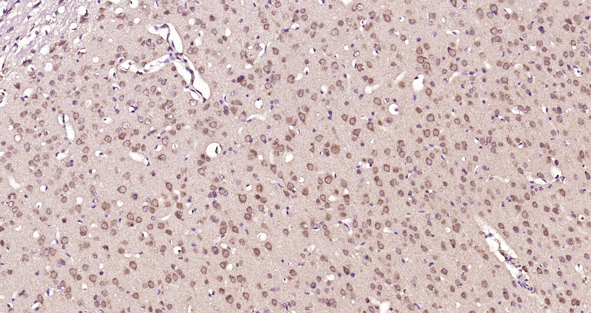 Paraformaldehyde-fixed, paraffin embedded Rat brain; Antigen retrieval by boiling in sodium citrate buffer (pH6.0) for 15min; Block endogenous peroxidase by 3% hydrogen peroxide for 20 minutes; Blocking buffer (normal goat serum) at 37°C for 30min; Antibody incubation with GK5 Polyclonal Antibody, Unconjugated (bs-8408R) at 1:200 overnight at 4°C, DAB staining.