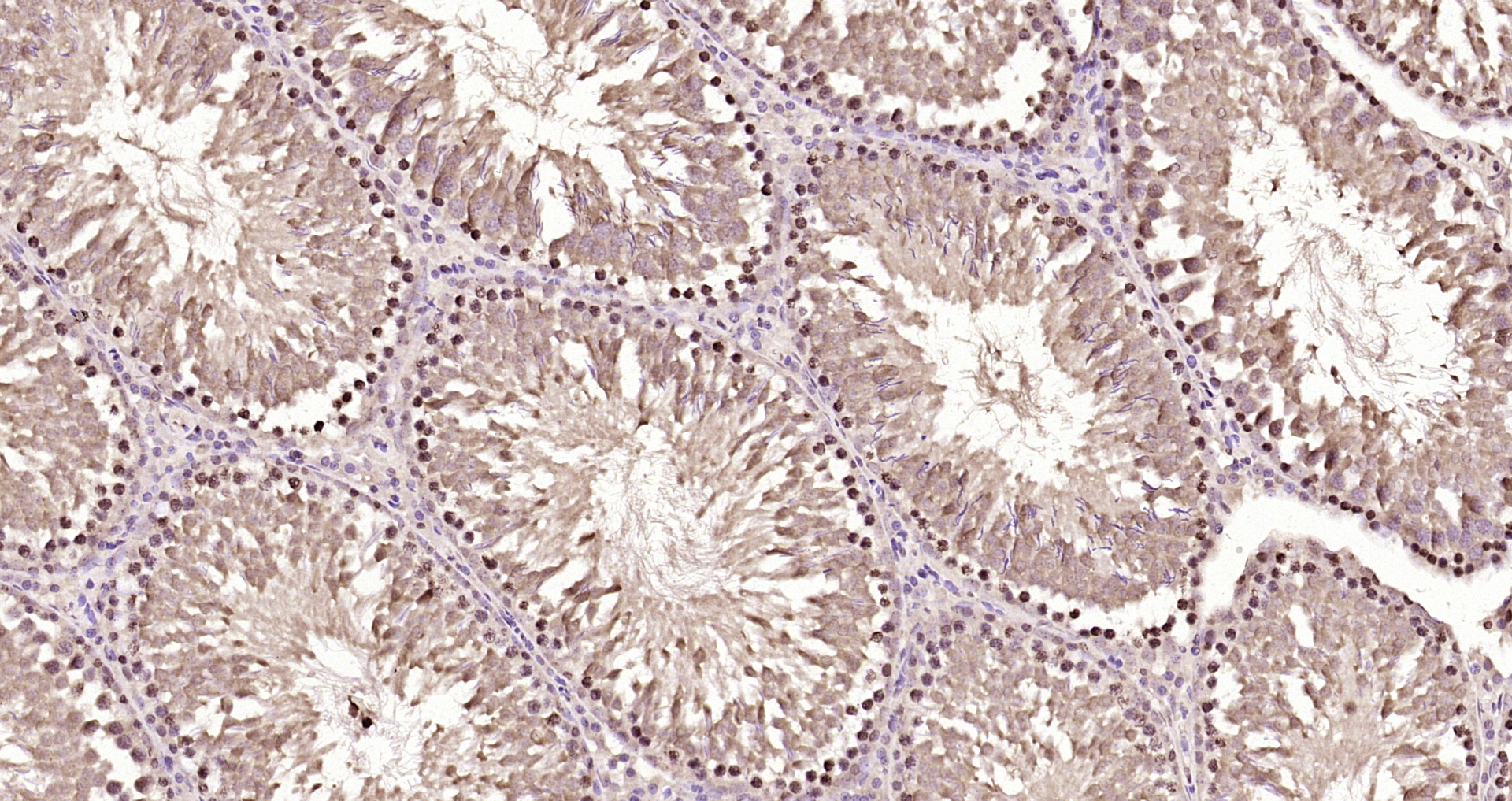 Paraformaldehyde-fixed, paraffin embedded Rat testis; Antigen retrieval by boiling in sodium citrate buffer (pH6.0) for 15min; Block endogenous peroxidase by 3% hydrogen peroxide for 20 minutes; Blocking buffer (normal goat serum) at 37°C for 30min; Antibody incubation with IGF2BP1 Polyclonal Antibody, Unconjugated (bs-8683R) at 1:200 overnight at 4°C, DAB staining.