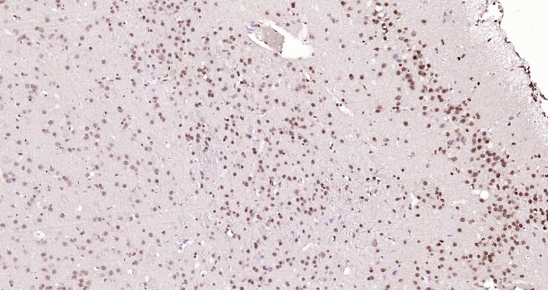 Paraformaldehyde-fixed, paraffin embedded Rat brain; Antigen retrieval by boiling in sodium citrate buffer (pH6.0) for 15min; Block endogenous peroxidase by 3% hydrogen peroxide for 20 minutes; Blocking buffer (normal goat serum) at 37°C for 30min; Antibody incubation with COPS7A Polyclonal Antibody, Unconjugated (bs-9124R) at 1:200 overnight at 4°C, DAB staining.