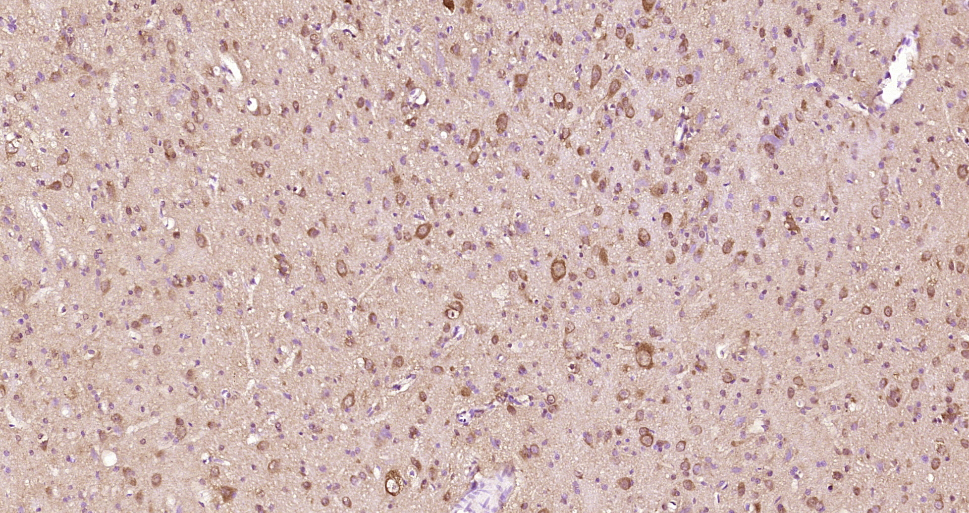 Paraformaldehyde-fixed, paraffin embedded Rat brain; Antigen retrieval by boiling in sodium citrate buffer (pH6.0) for 15min; Block endogenous peroxidase by 3% hydrogen peroxide for 20 minutes; Blocking buffer (normal goat serum) at 37°C for 30min; Antibody incubation with TNNI3K Polyclonal Antibody, Unconjugated (bs-9458R) at 1:200 overnight at 4°C, DAB staining.