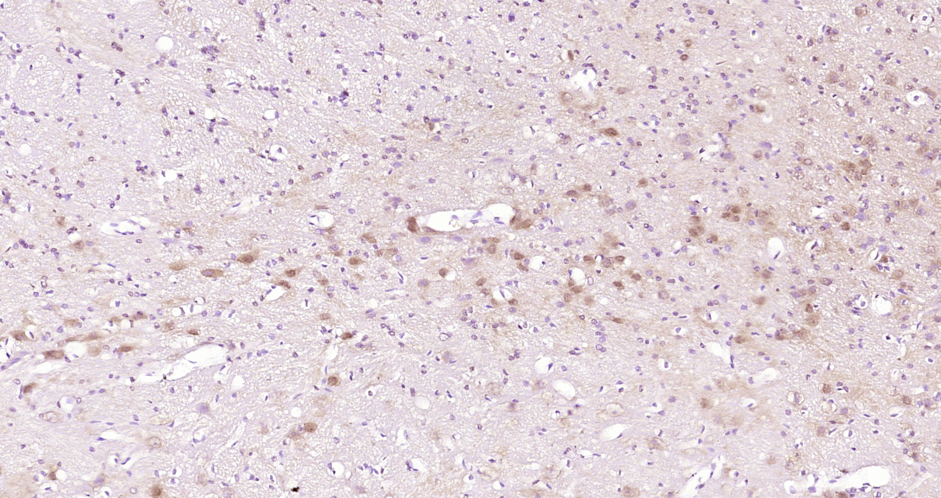 Paraformaldehyde-fixed, paraffin embedded Rat brain; Antigen retrieval by boiling in sodium citrate buffer (pH6.0) for 15min; Block endogenous peroxidase by 3% hydrogen peroxide for 20 minutes; Blocking buffer (normal goat serum) at 37°C for 30min; Antibody incubation with TNIP1 Polyclonal Antibody, Unconjugated (bs-9568R) at 1:200 overnight at 4°C, DAB staining.