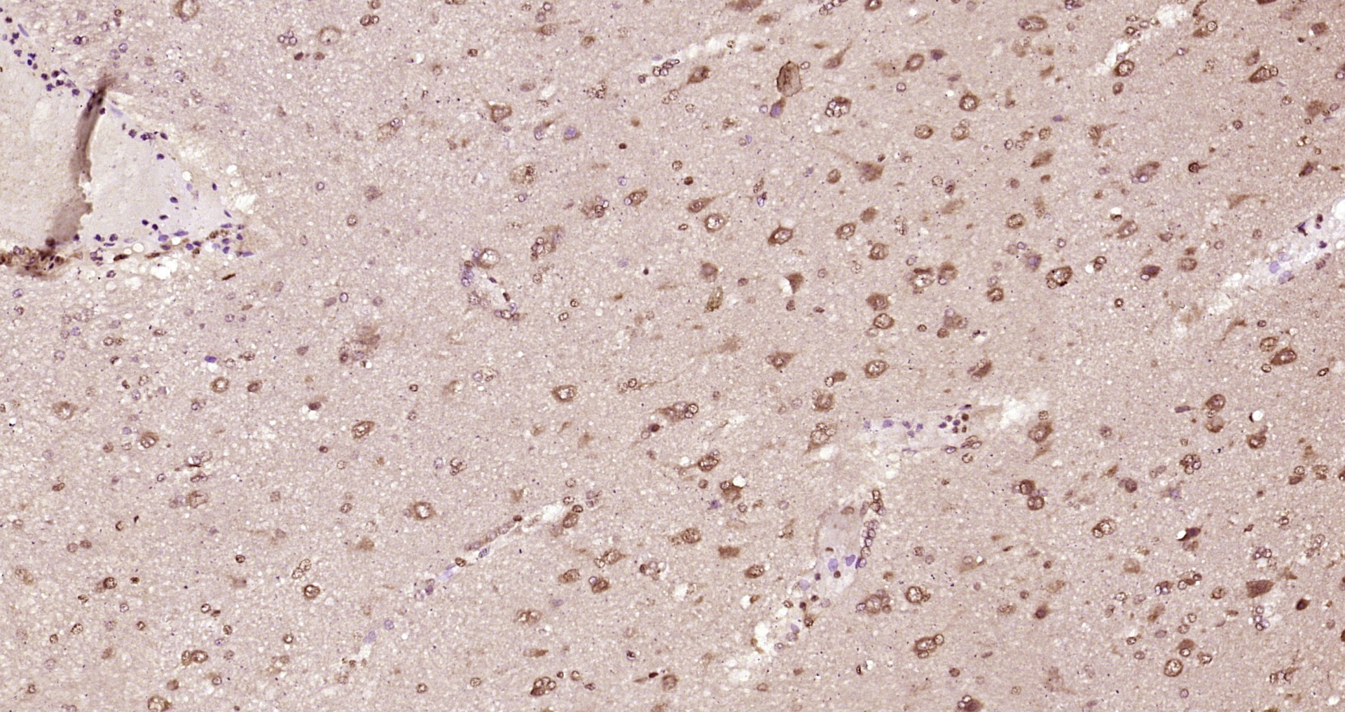 Paraformaldehyde-fixed, paraffin embedded Human brain; Antigen retrieval by boiling in sodium citrate buffer (pH6.0) for 15min; Block endogenous peroxidase by 3% hydrogen peroxide for 20 minutes; Blocking buffer (normal goat serum) at 37°C for 30min; Antibody incubation with INTS3 Polyclonal Antibody, Unconjugated (bs-9766R) at 1:200 overnight at 4°C, DAB staining.