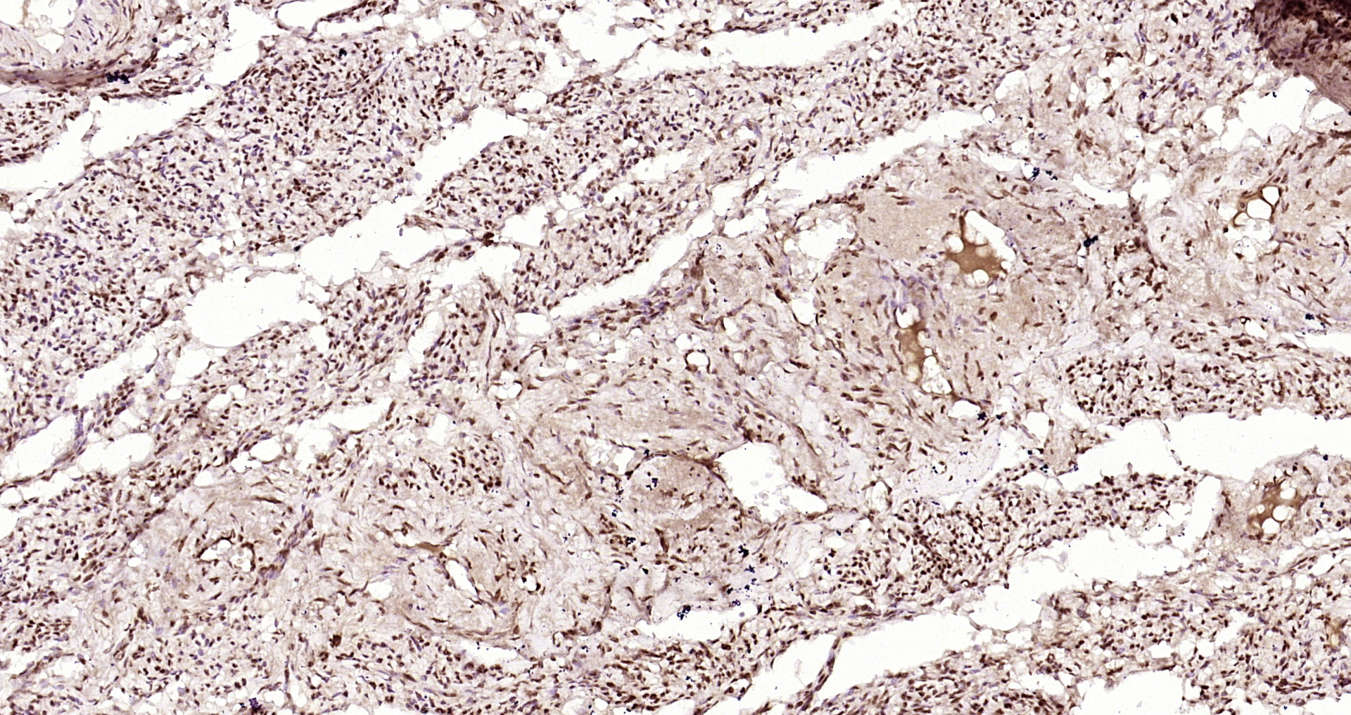 Paraformaldehyde-fixed, paraffin embedded Human uterus; Antigen retrieval by boiling in sodium citrate buffer (pH6.0) for 15min; Block endogenous peroxidase by 3% hydrogen peroxide for 20 minutes; Blocking buffer (normal goat serum) at 37°C for 30min; Antibody incubation with INTS3 Polyclonal Antibody, Unconjugated (bs-9766R) at 1:200 overnight at 4°C, DAB staining.