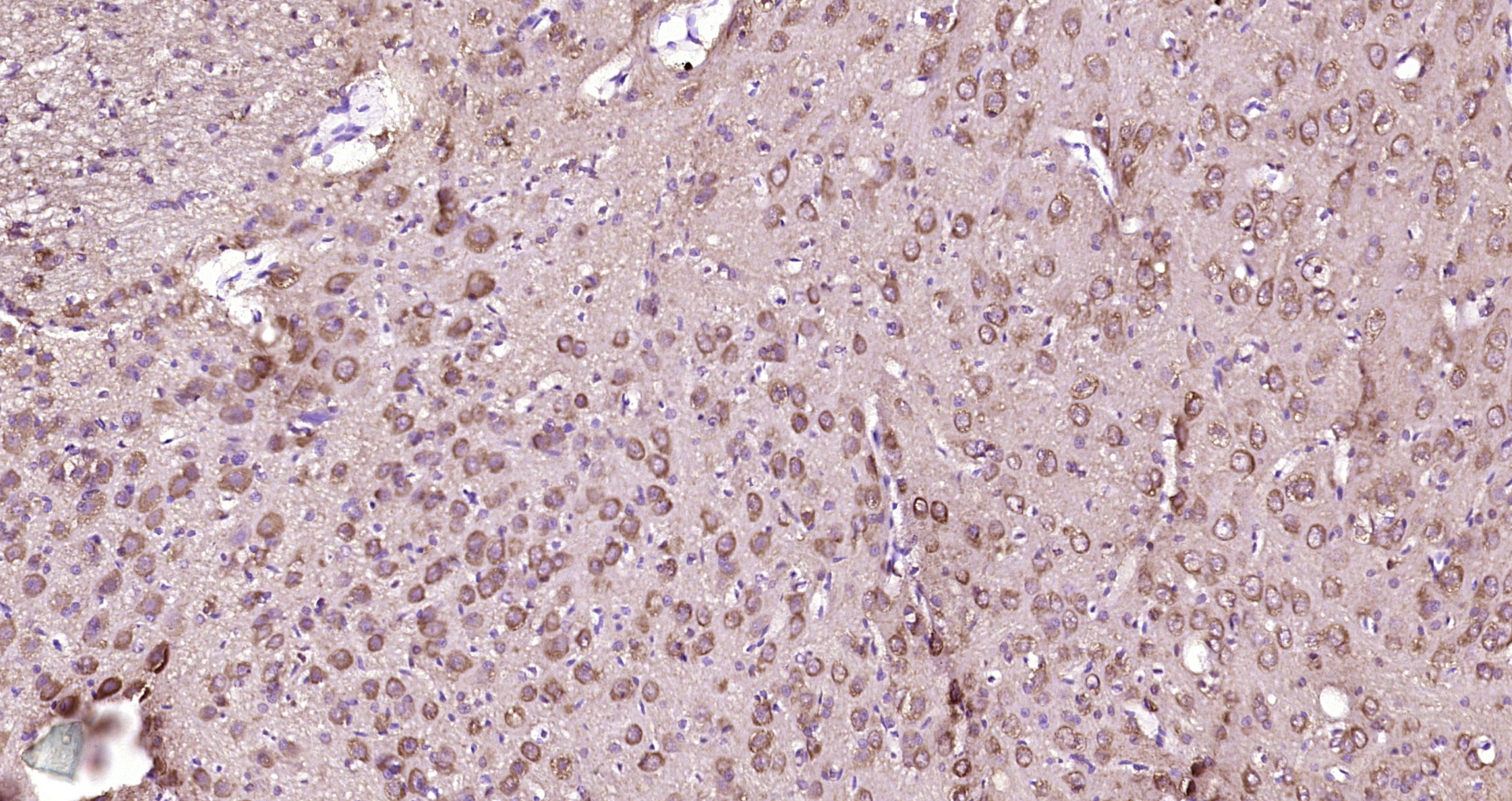 Paraformaldehyde-fixed, paraffin embedded Rat brain; Antigen retrieval by boiling in sodium citrate buffer (pH6.0) for 15min; Block endogenous peroxidase by 3% hydrogen peroxide for 20 minutes; Blocking buffer (normal goat serum) at 37°C for 30min; Antibody incubation with CRHBP Polyclonal Antibody, Unconjugated (bs-9906R) at 1:200 overnight at 4°C, DAB staining. Paraformaldehyde-fixed, paraffin embedded Rat brain; Antigen retrieval by boiling in sodium citrate buffer (pH6.0) for 15min; Block endogenous peroxidase by 3% hydrogen peroxide for 20 minutes; Blocking buffer (normal goat serum) at 37°C for 30min; Antibody incubation with CRHBP Polyclonal Antibody, Unconjugated (bs-9906R) at 1:200 overnight at 4°C, DAB staining.