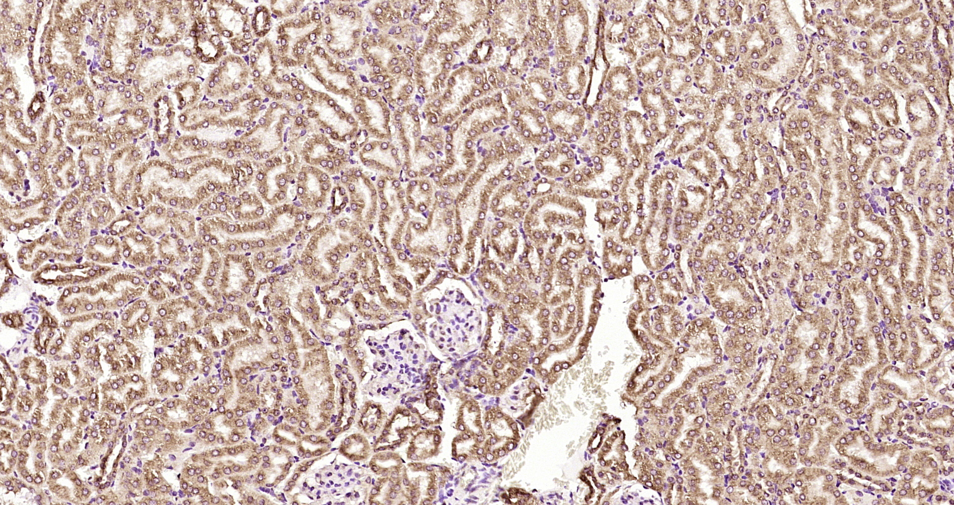 Paraformaldehyde-fixed, paraffin embedded Mouse kidney; Antigen retrieval by boiling in sodium citrate buffer (pH6.0) for 15min; Block endogenous peroxidase by 3% hydrogen peroxide for 20 minutes; Blocking buffer (normal goat serum) at 37°C for 30min; Antibody incubation with CRHBP Polyclonal Antibody, Unconjugated (bs-9906R) at 1:200 overnight at 4°C, DAB staining.