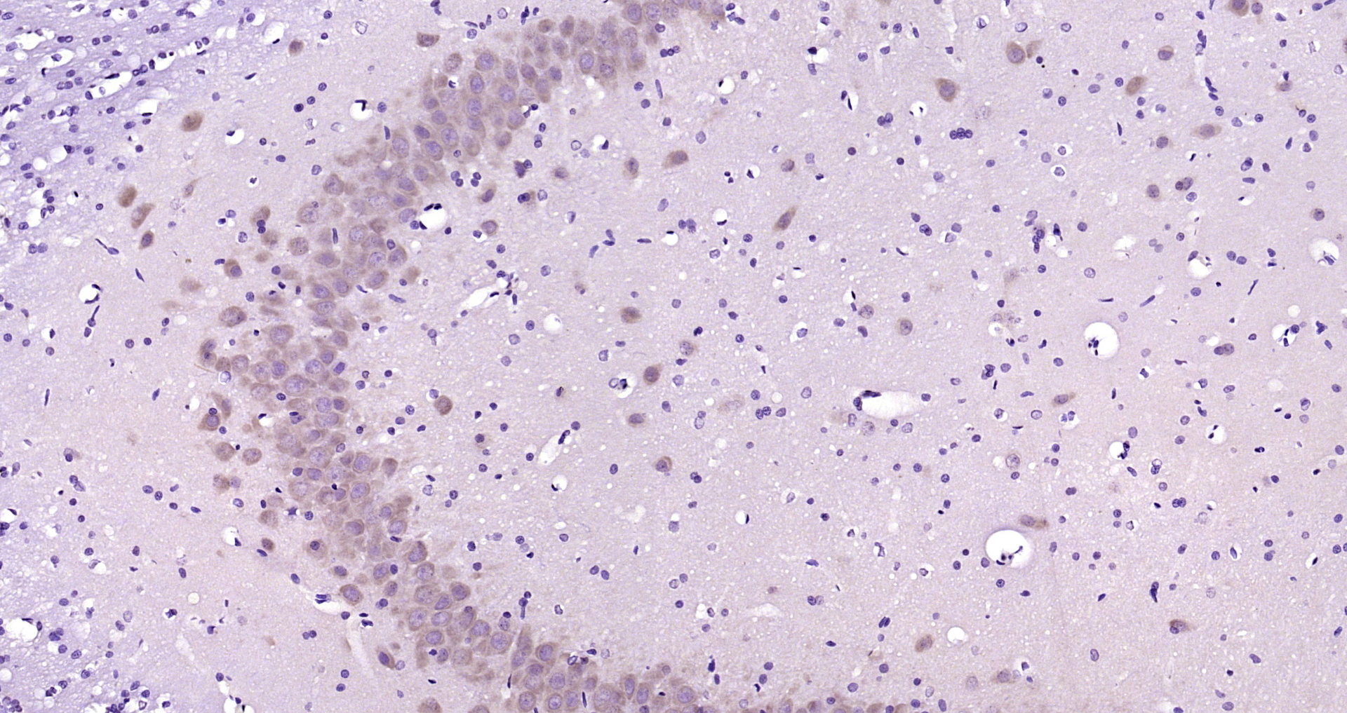 Paraformaldehyde-fixed, paraffin embedded Rat brain; Antigen retrieval by boiling in sodium citrate buffer (pH6.0) for 15min; Block endogenous peroxidase by 3% hydrogen peroxide for 20 minutes; Blocking buffer (normal goat serum) at 37°C for 30min; Antibody incubation with PCP4/PEP-19 Polyclonal Antibody, Unconjugated (bs-11326R) at 1:200 overnight at 4°C, DAB staining. Paraformaldehyde-fixed, paraffin embedded Rat brain; Antigen retrieval by boiling in sodium citrate buffer (pH6.0) for 15min; Block endogenous peroxidase by 3% hydrogen peroxide for 20 minutes; Blocking buffer (normal goat serum) at 37°C for 30min; Antibody incubation with PCP4/PEP-19 Polyclonal Antibody, Unconjugated (bs-11326R) at 1:200 overnight at 4°C, DAB staining.